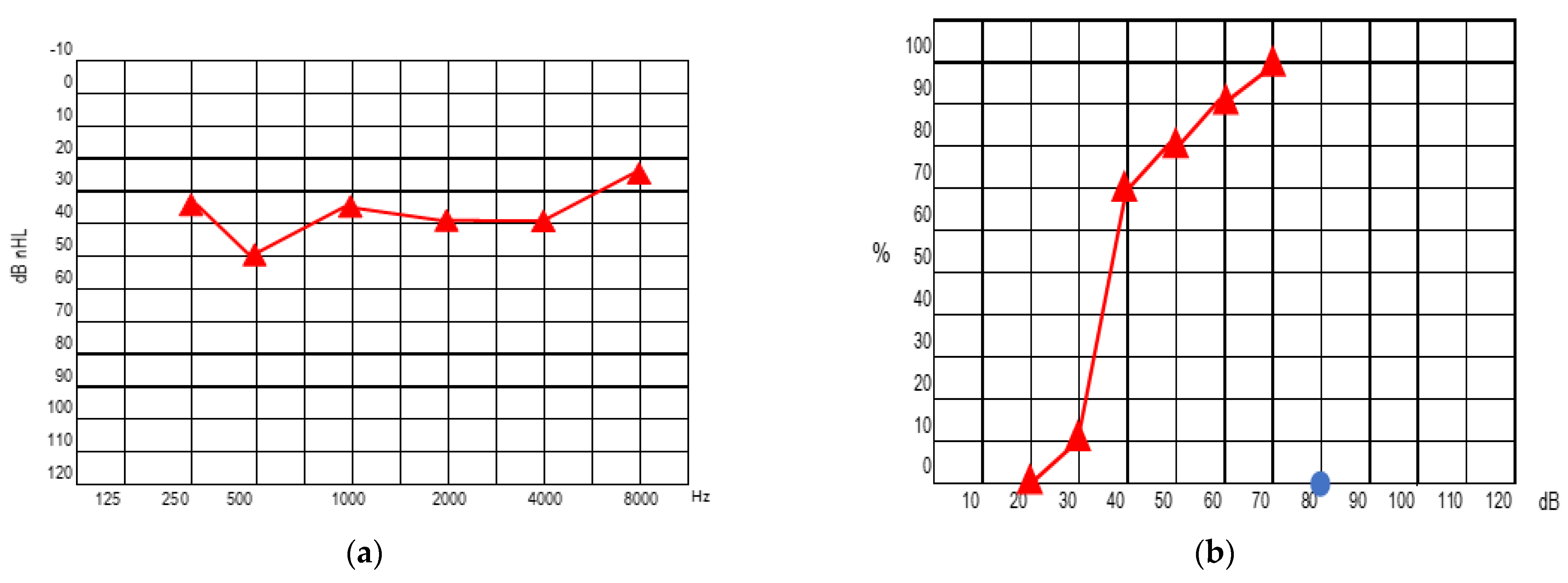 Audiolres 13 00017 g004