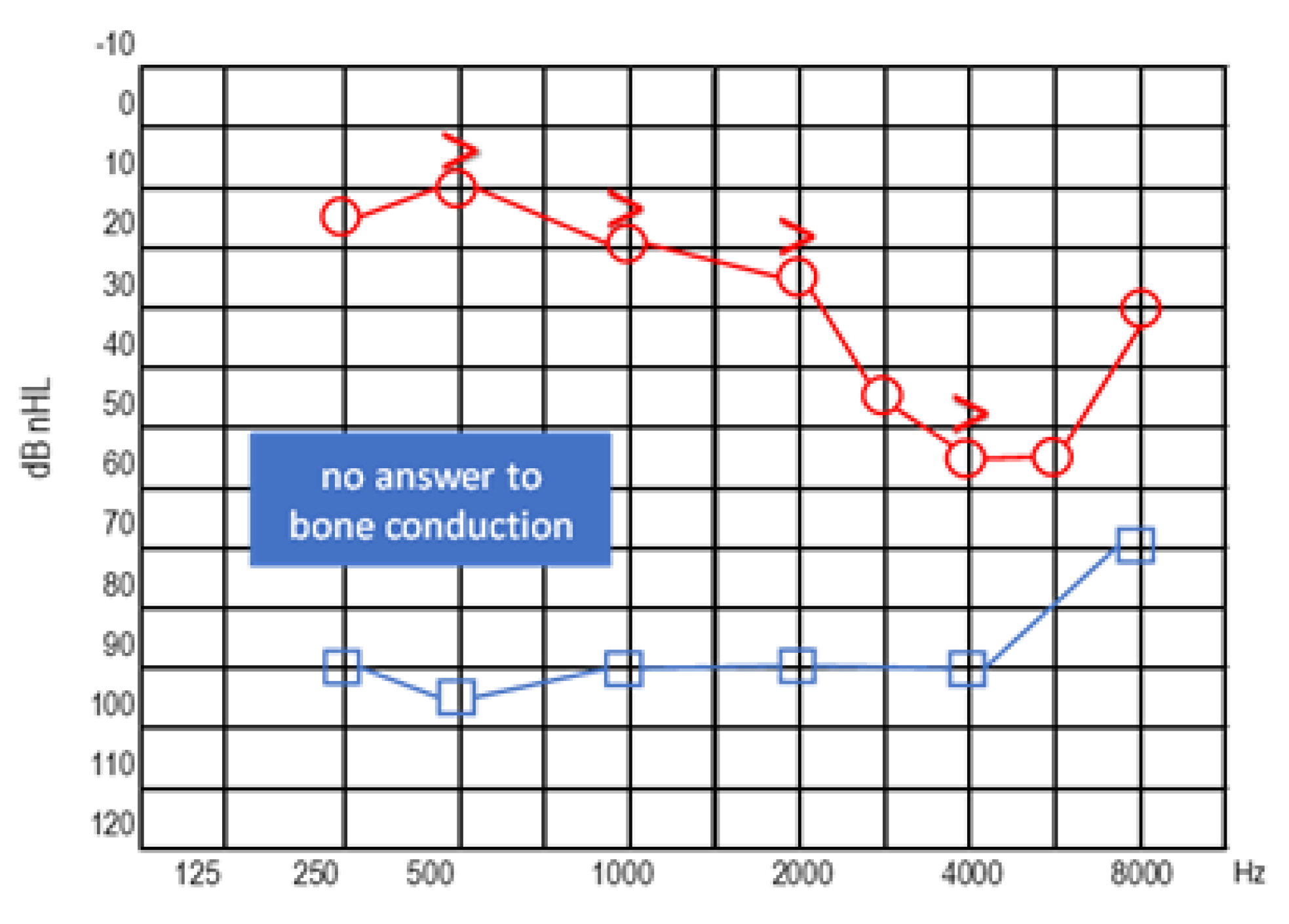 Audiolres 13 00017 g005