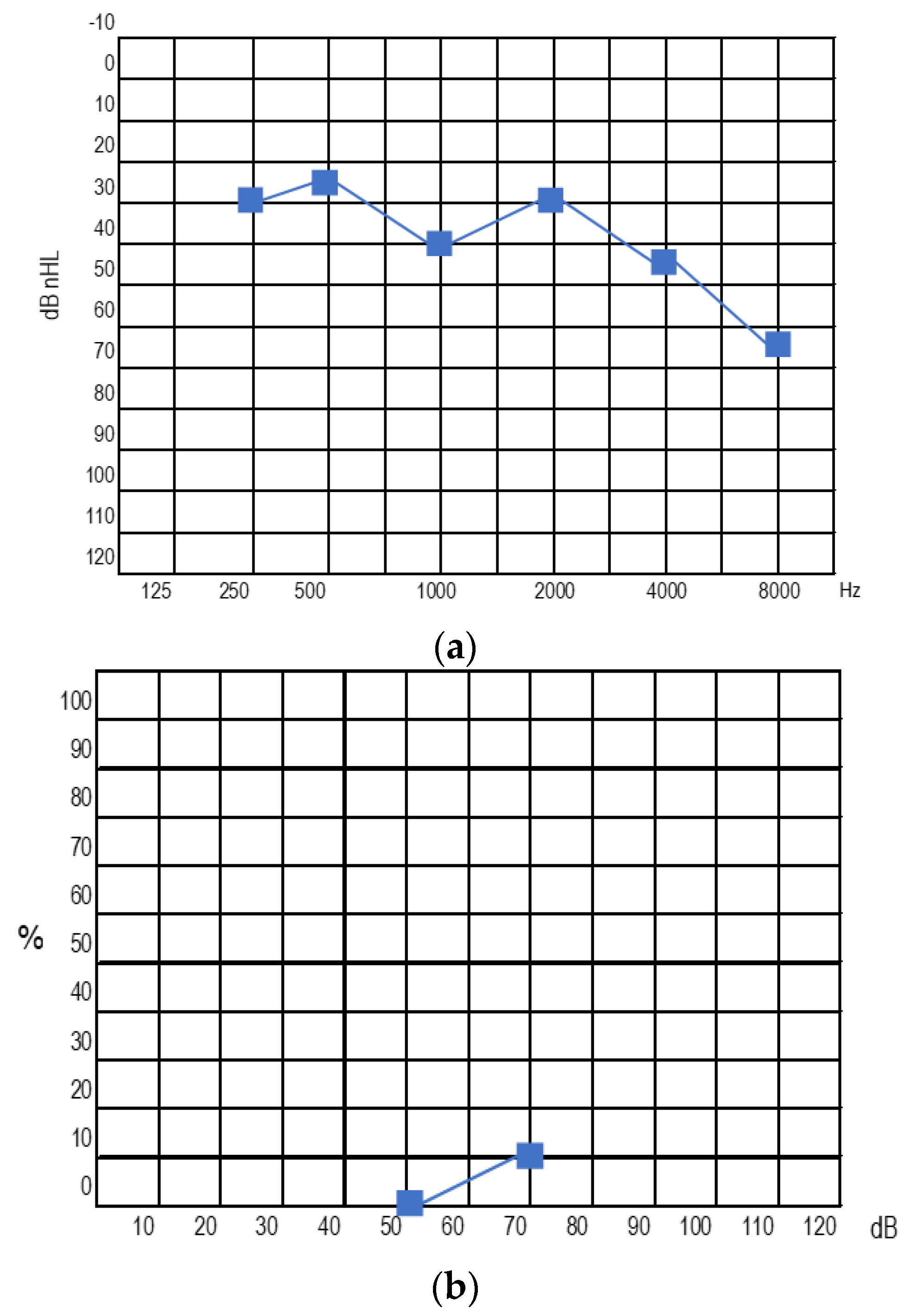 Audiolres 13 00017 g006