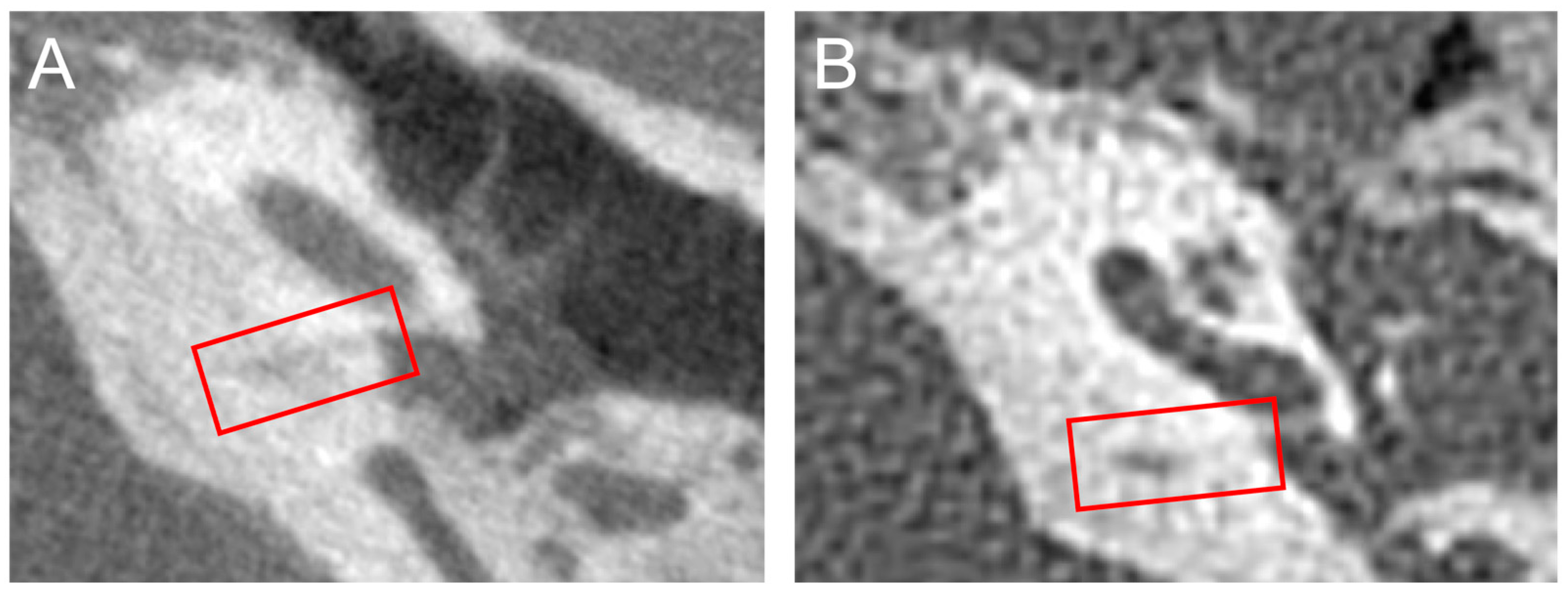 Audiolres 13 00032 g004 Audiolres 13 00032 g004