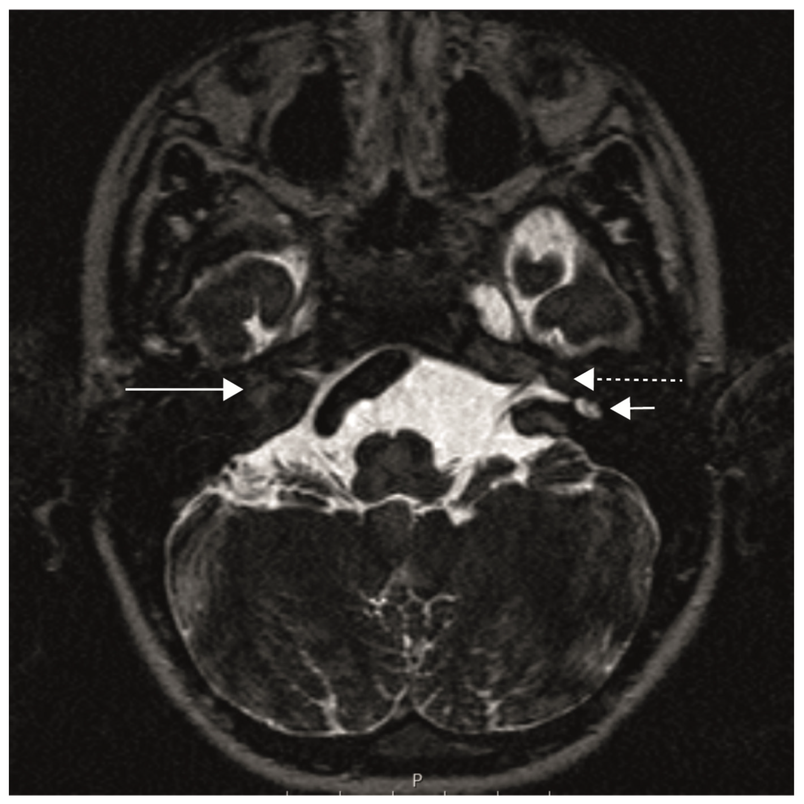 Audiolres 13 00040 g001 Audiolres 13 00040 g001