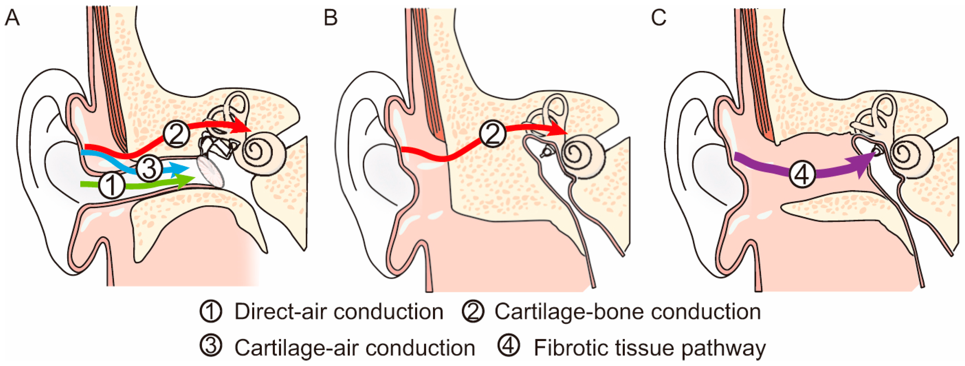 Audiolres 13 00045 g001 Audiolres 13 00045 g001