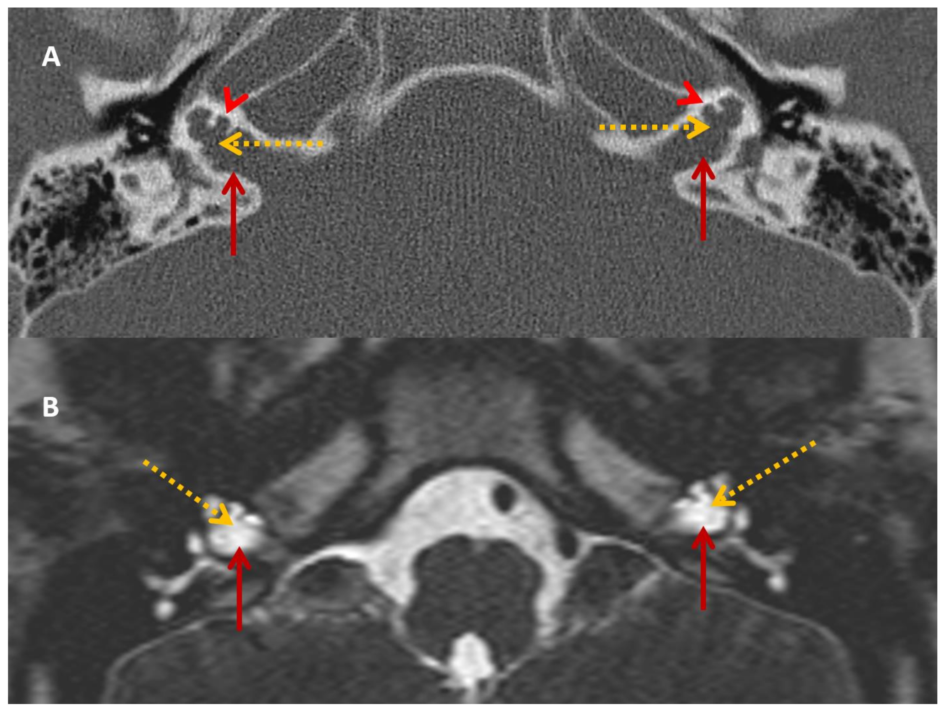Audiolres 13 00052 g002