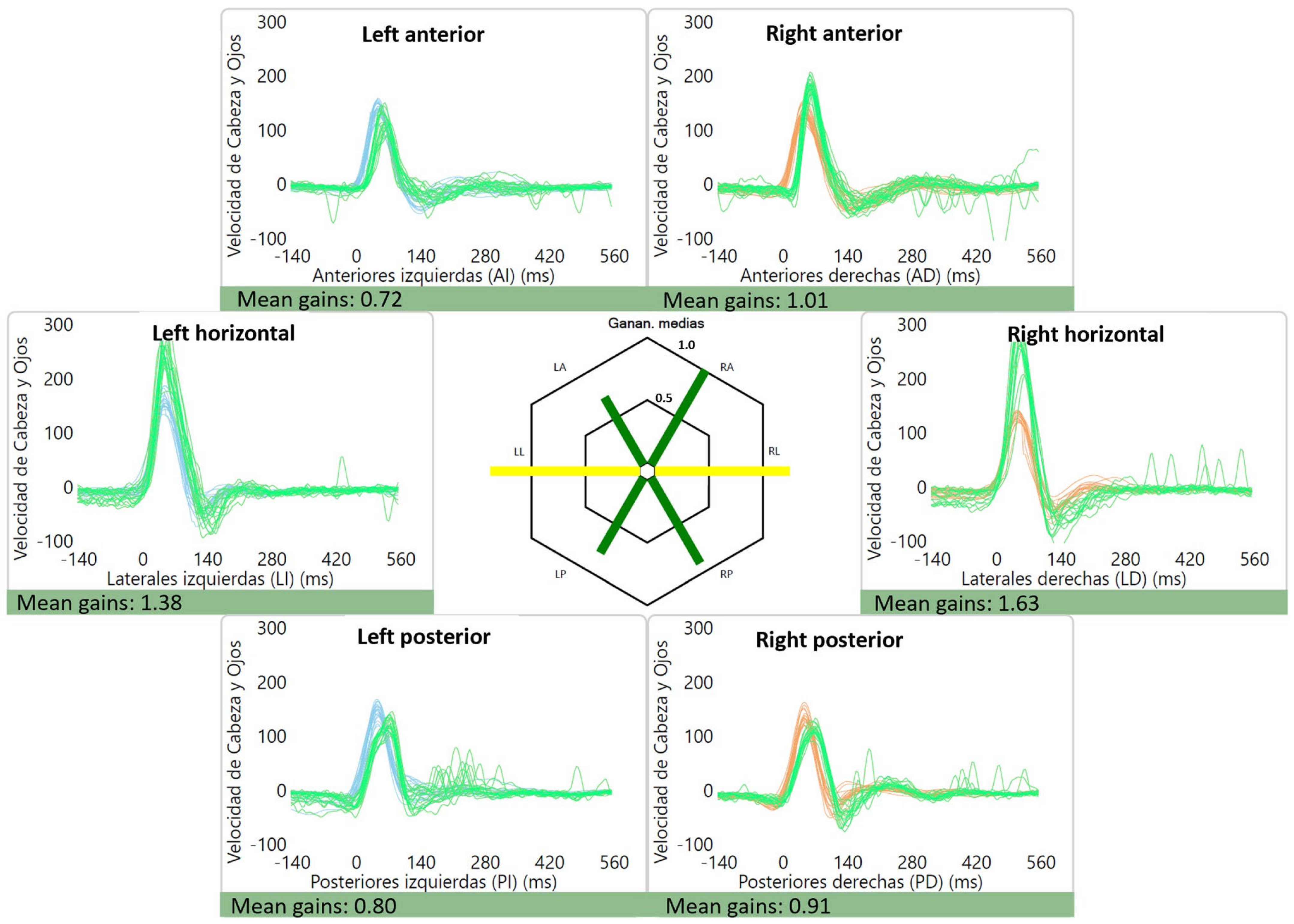 Audiolres 13 00053 g002 Audiolres 13 00053 g002