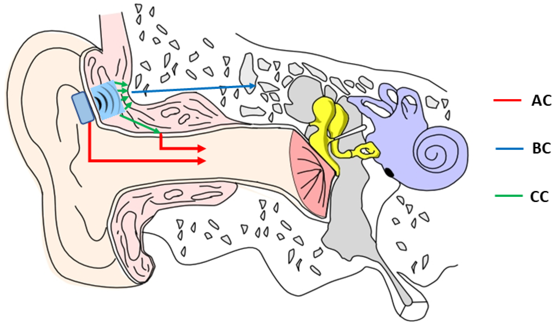 Audiolres 13 00055 g001