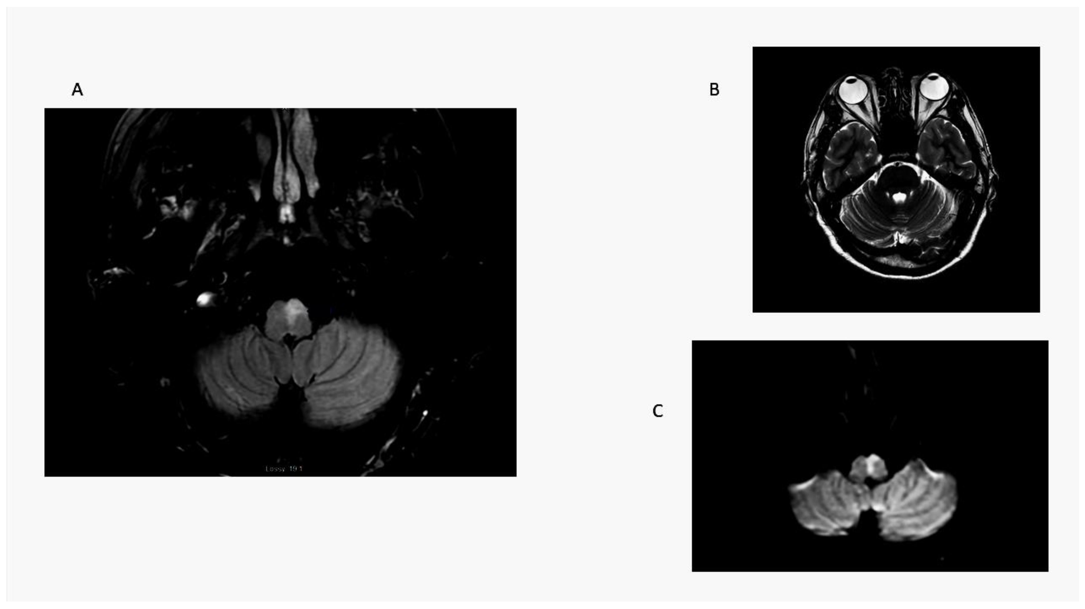 Audiolres 13 00068 g004 Audiolres 13 00068 g004