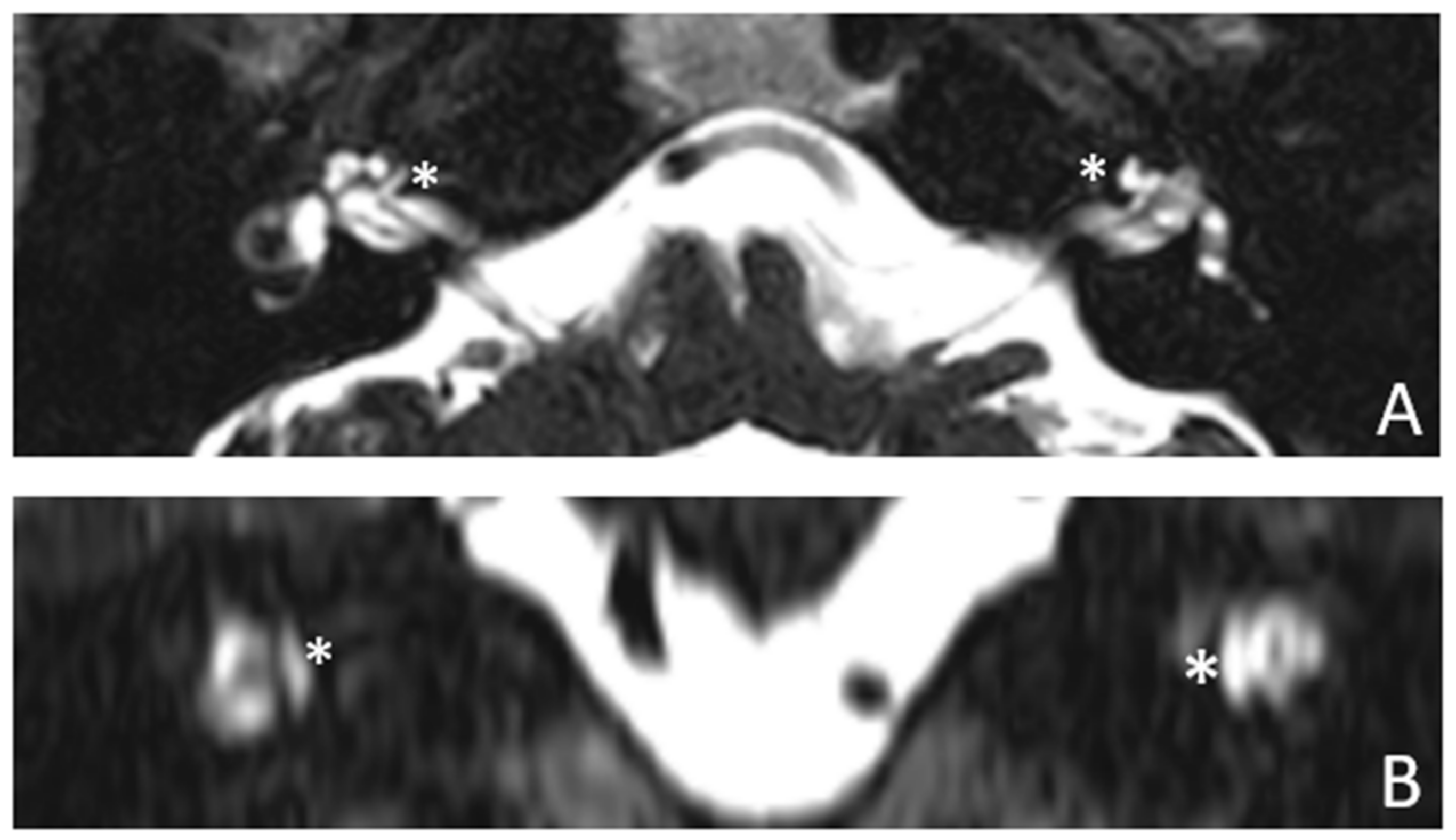 Audiolres 13 00072 g004