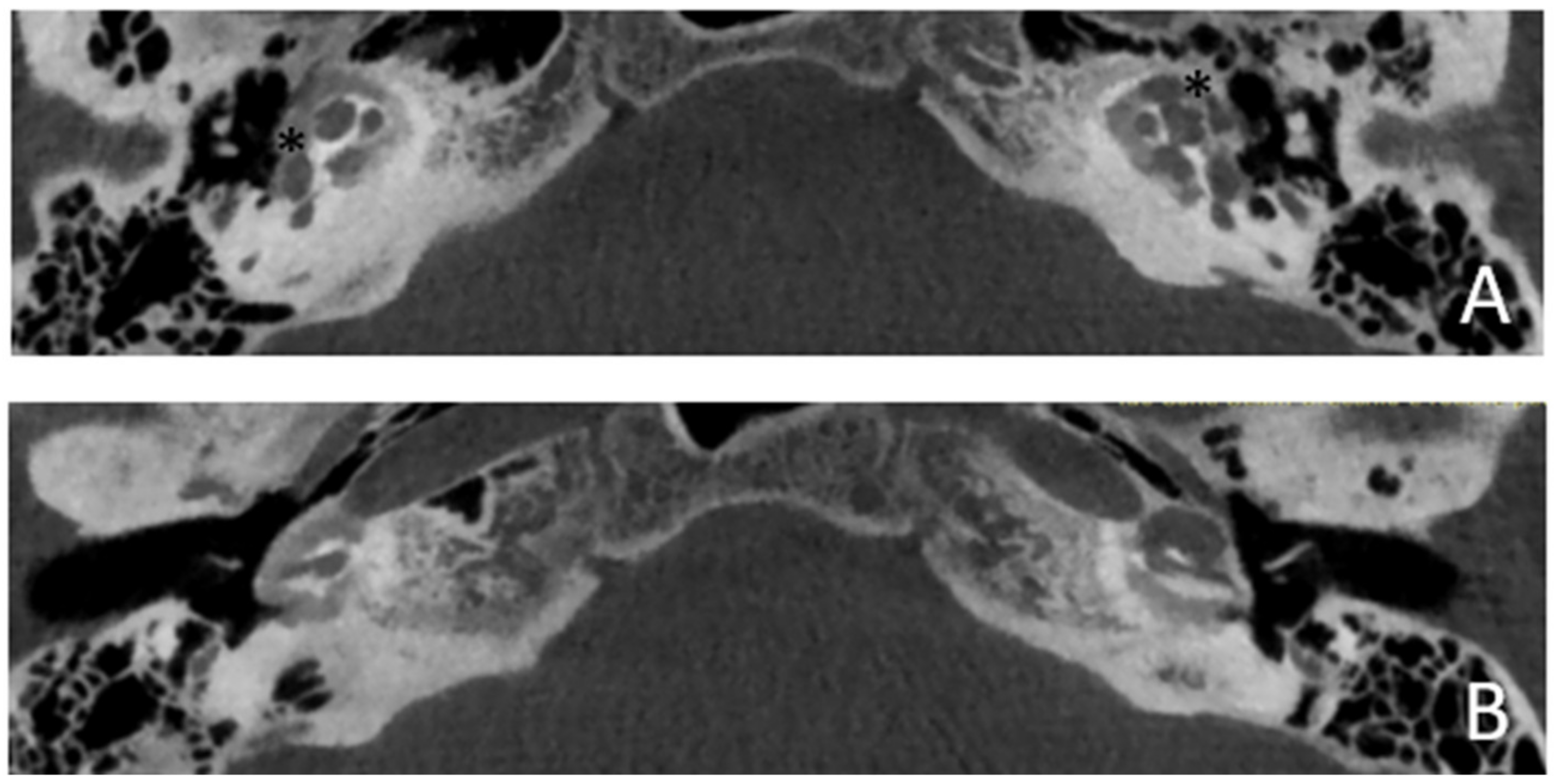 Audiolres 13 00072 g007