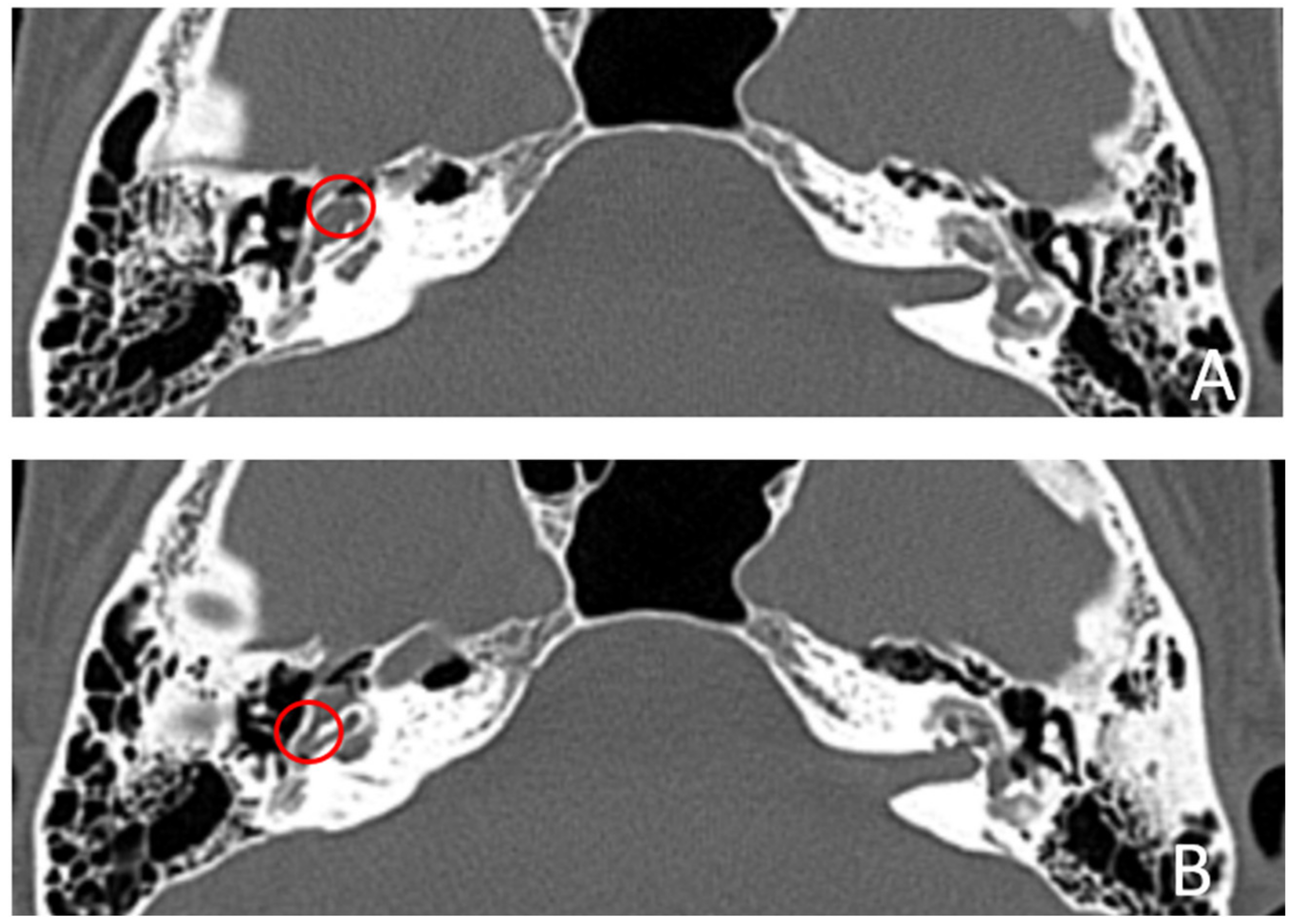 Audiolres 13 00072 g009