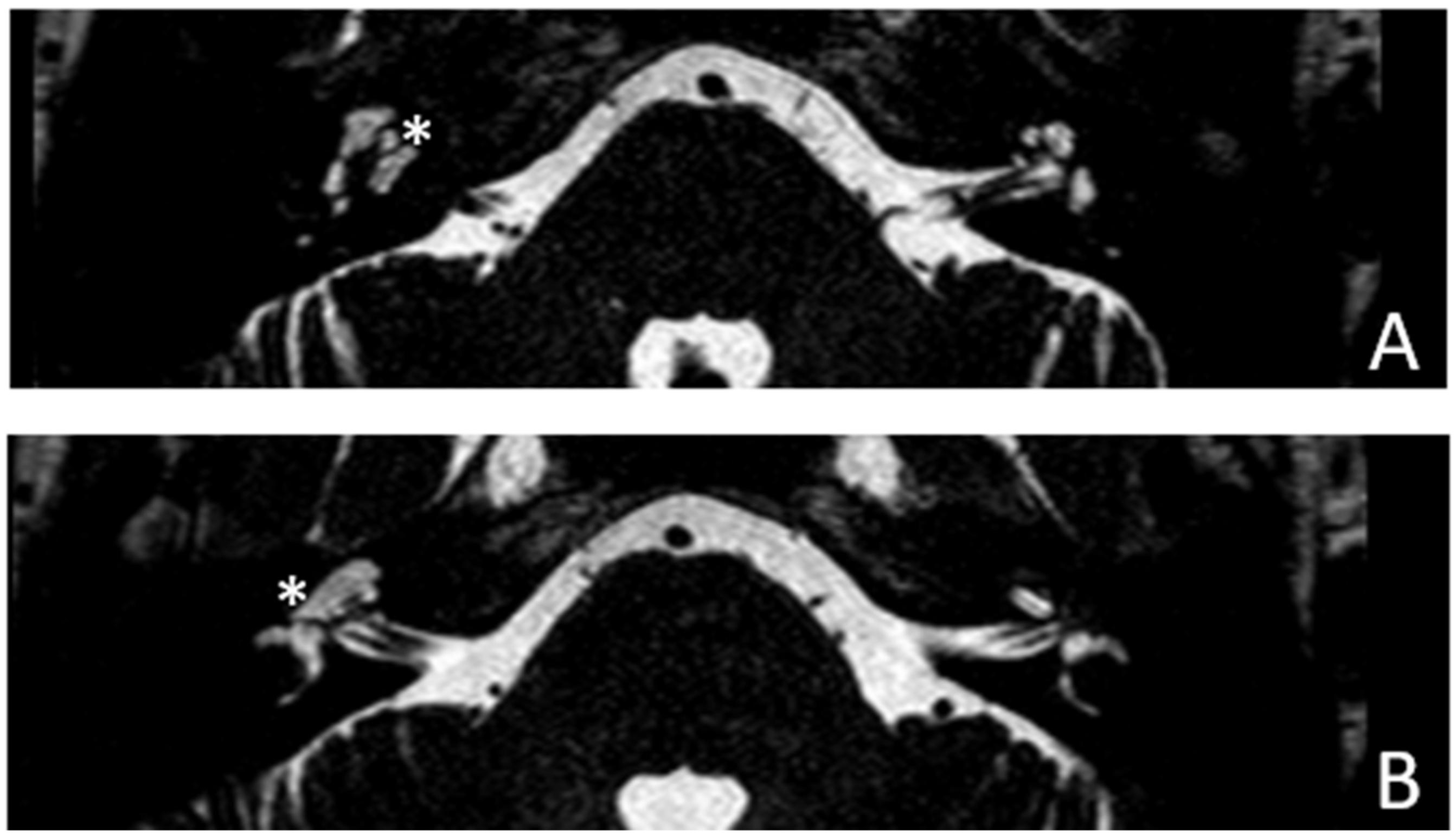 Audiolres 13 00072 g010