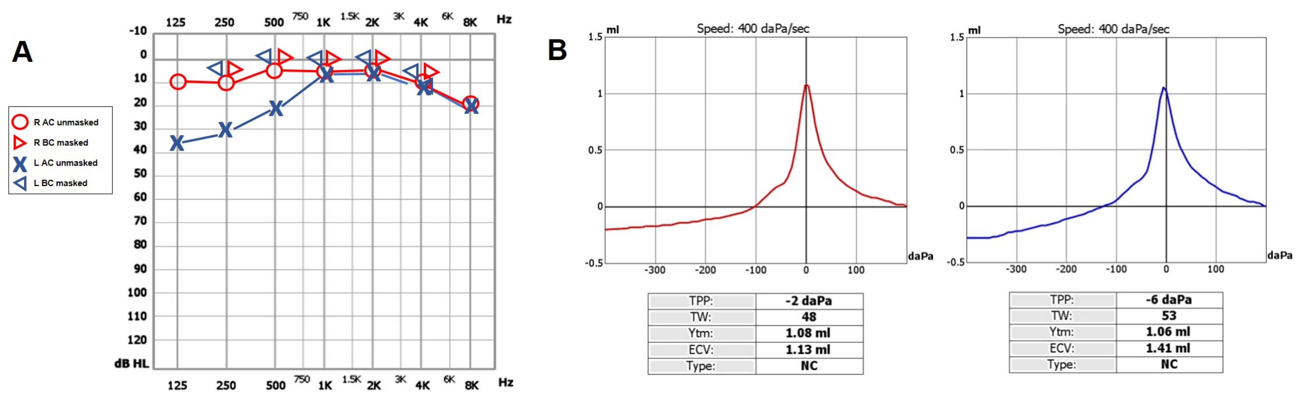 Audiolres 13 00073 g001