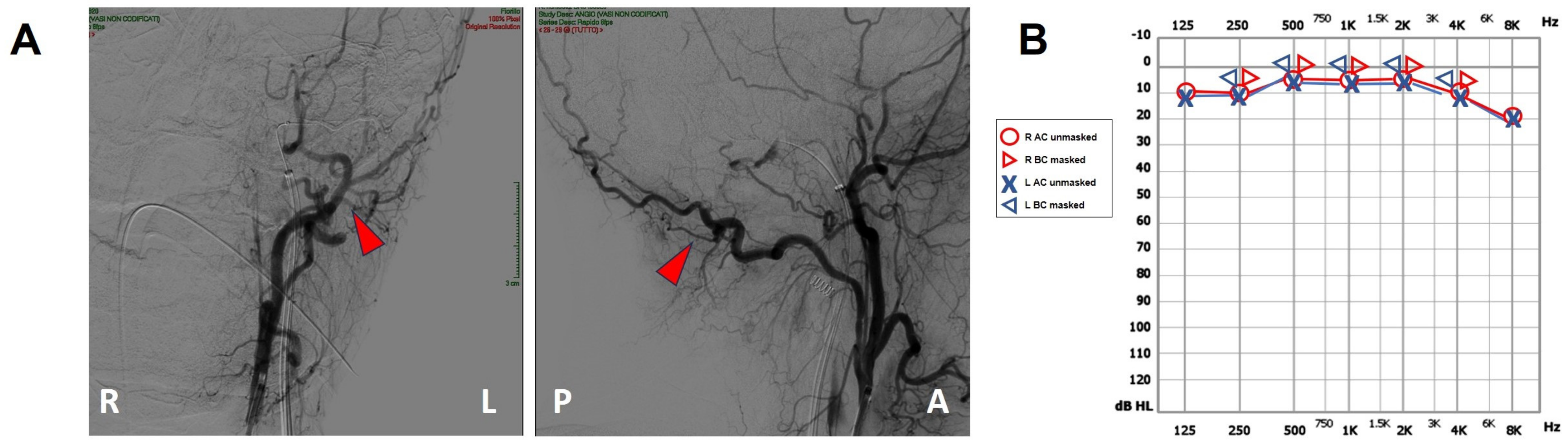 Audiolres 13 00073 g004