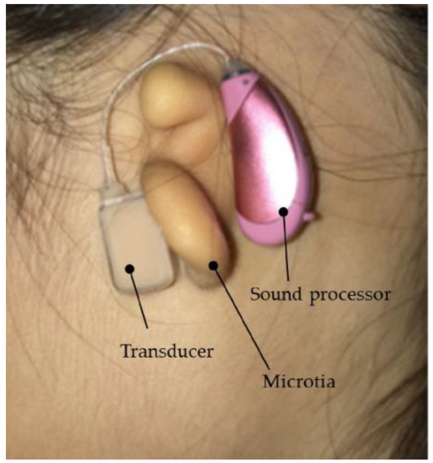 Audiolres 13 00076 g003