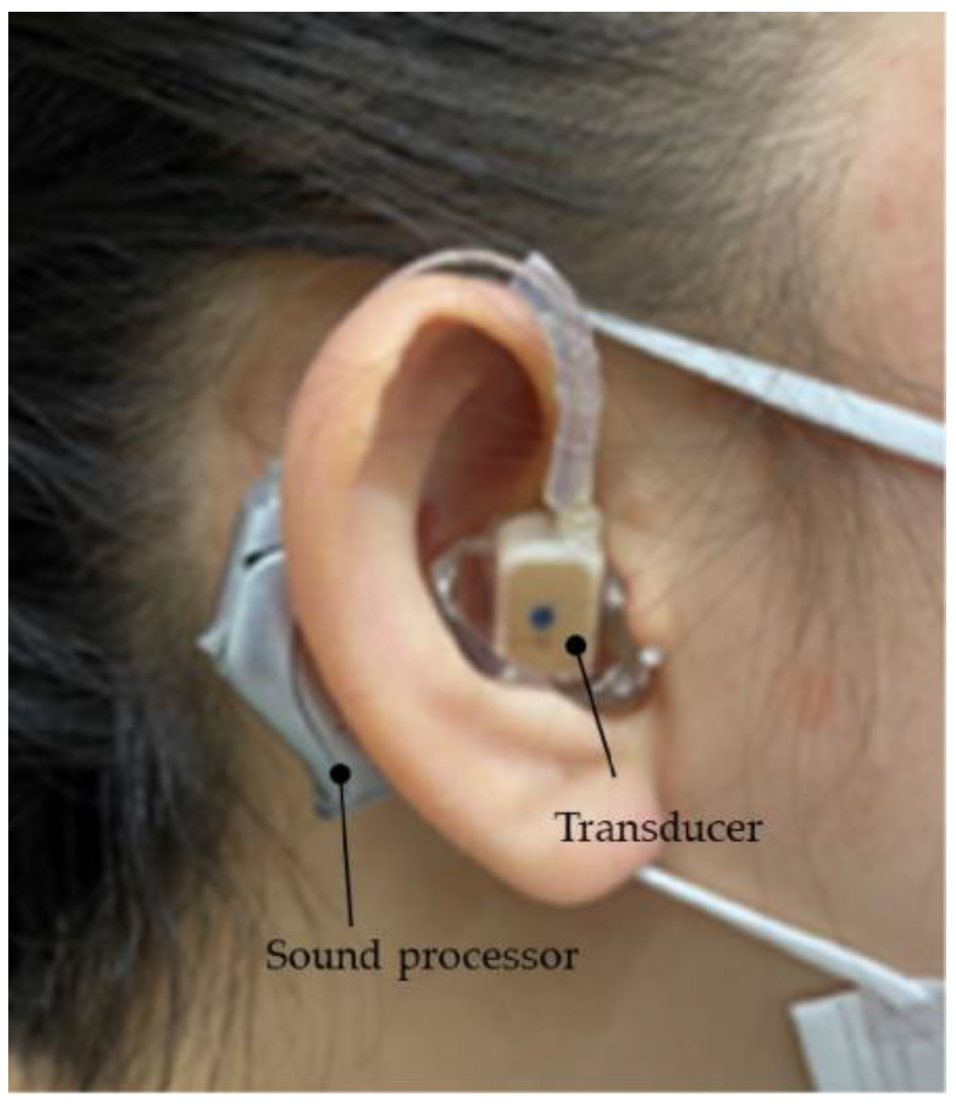 Audiolres 13 00076 g004