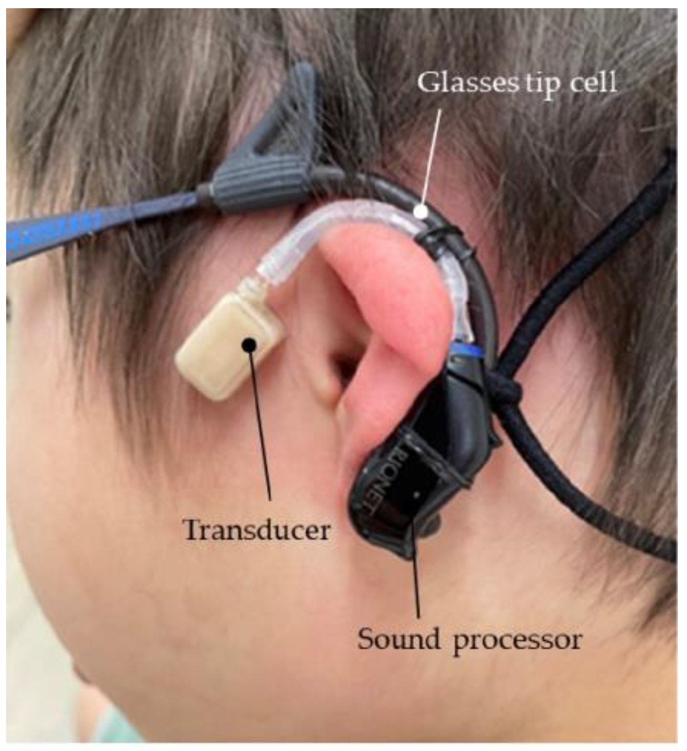 Audiolres 13 00076 g007