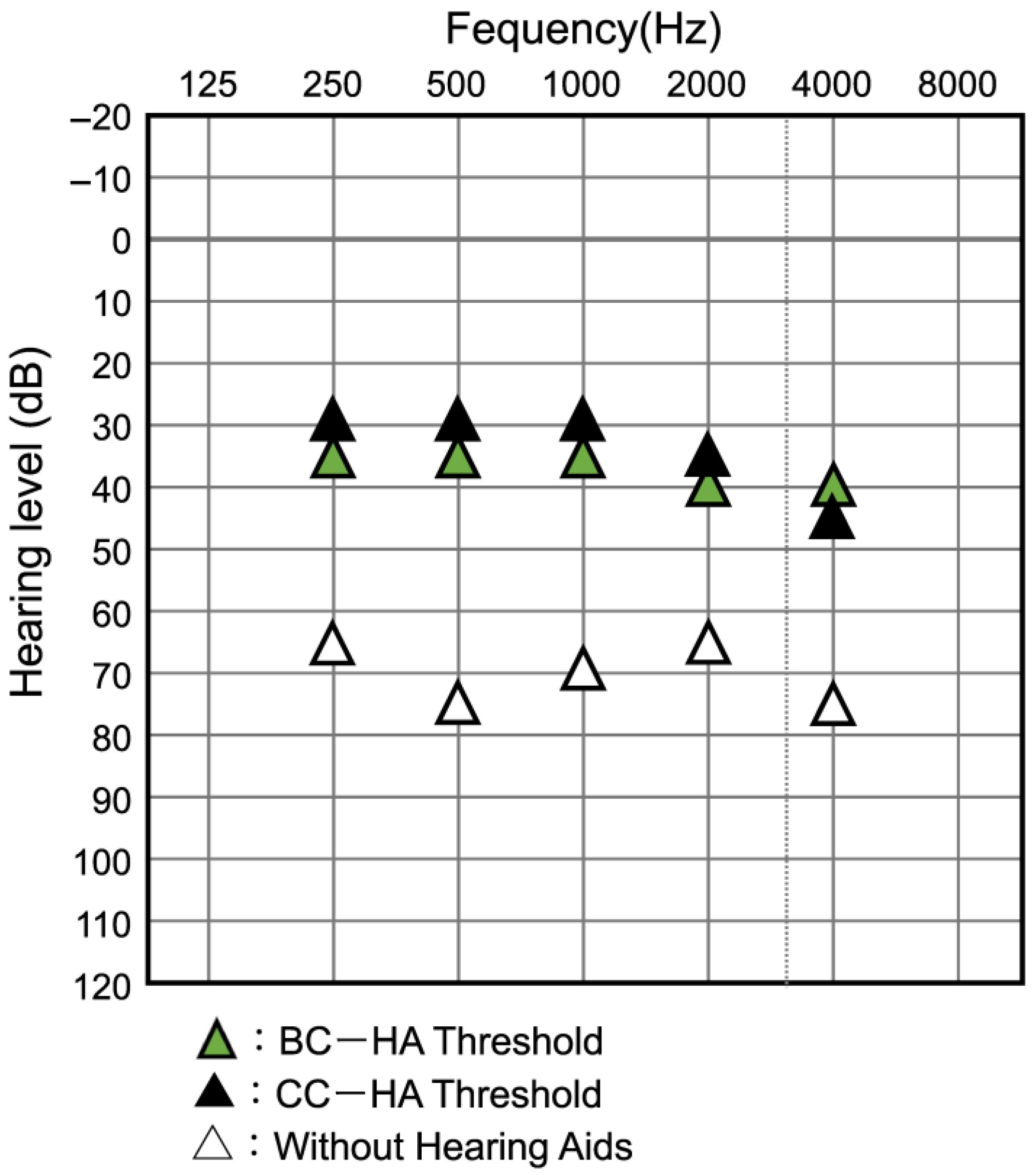 Audiolres 13 00076 g013