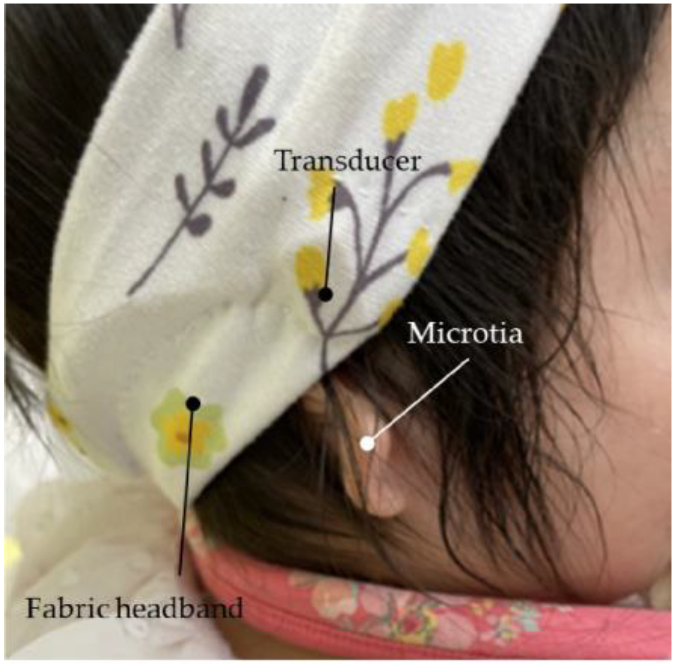 Audiolres 13 00076 g014