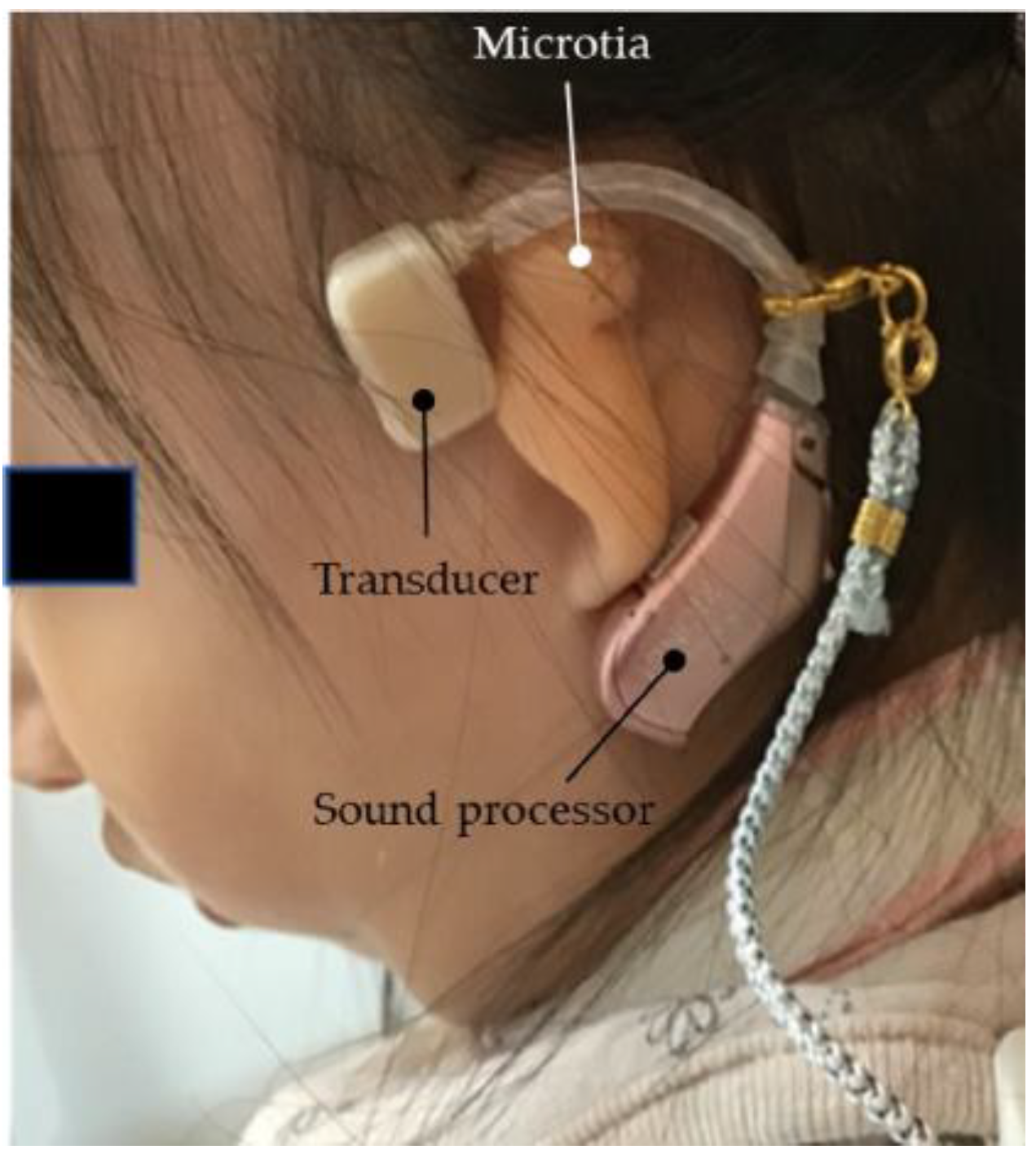 Audiolres 13 00076 g016