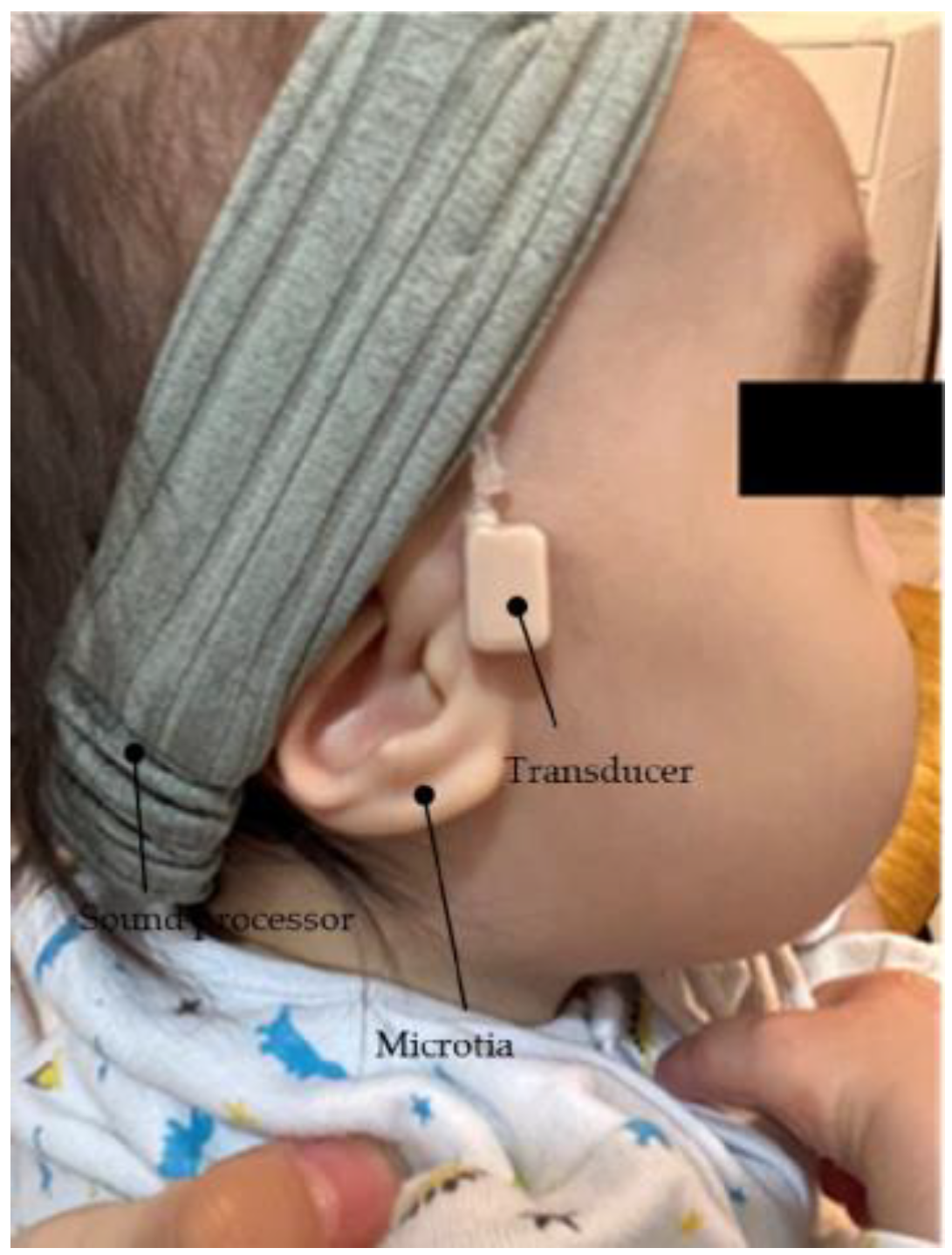 Audiolres 13 00076 g017