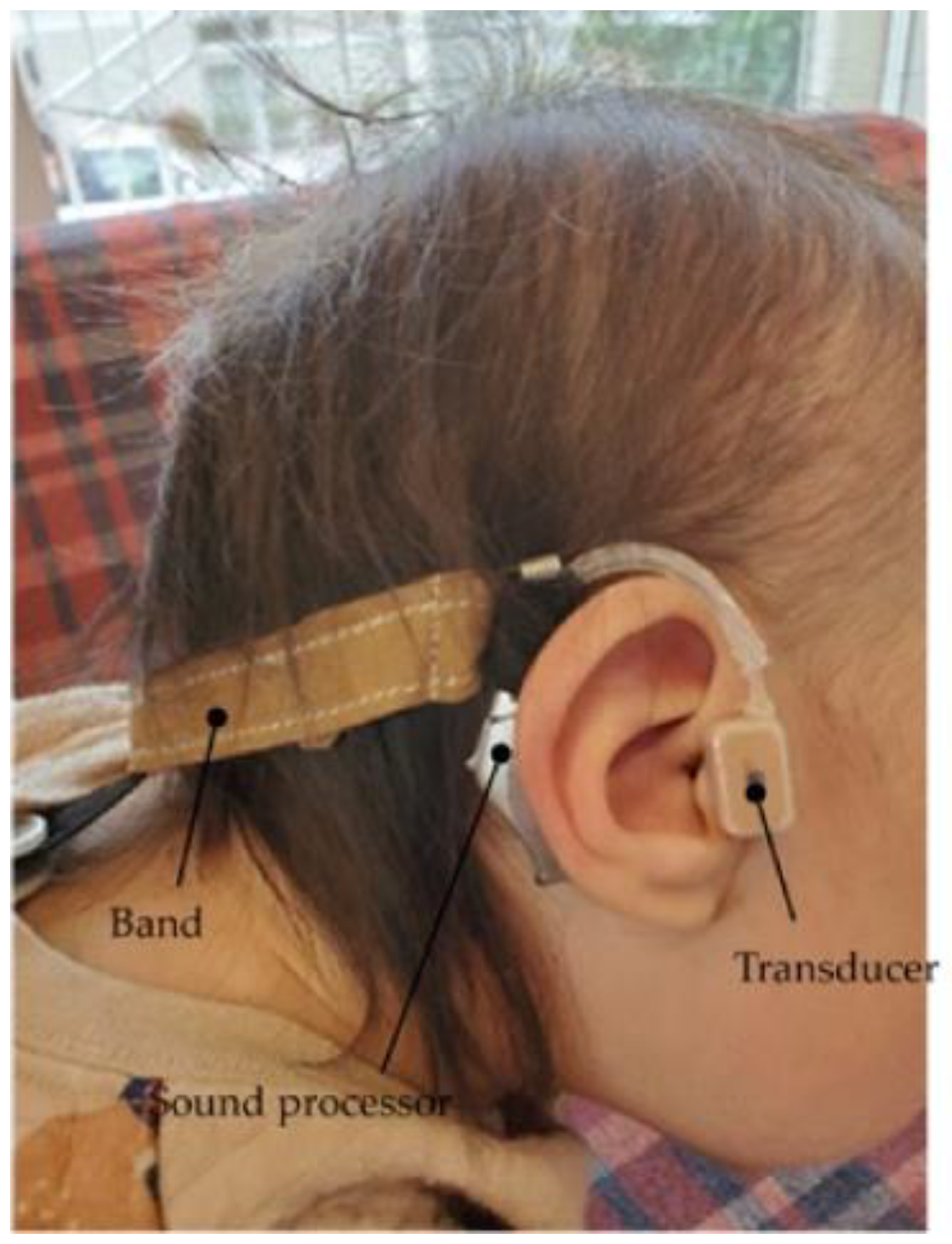 Audiolres 13 00076 g018