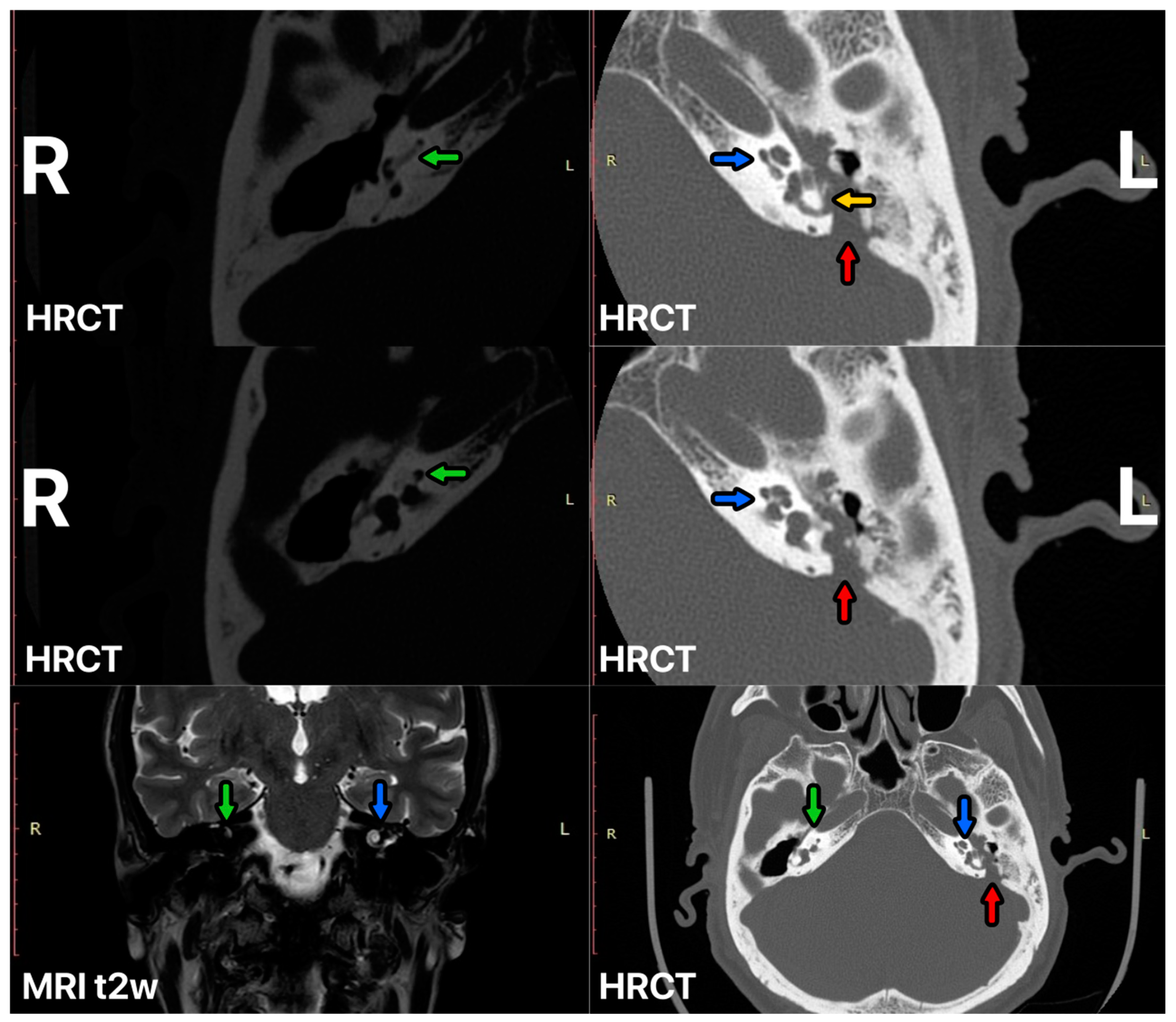 Audiolres 14 00025 g002