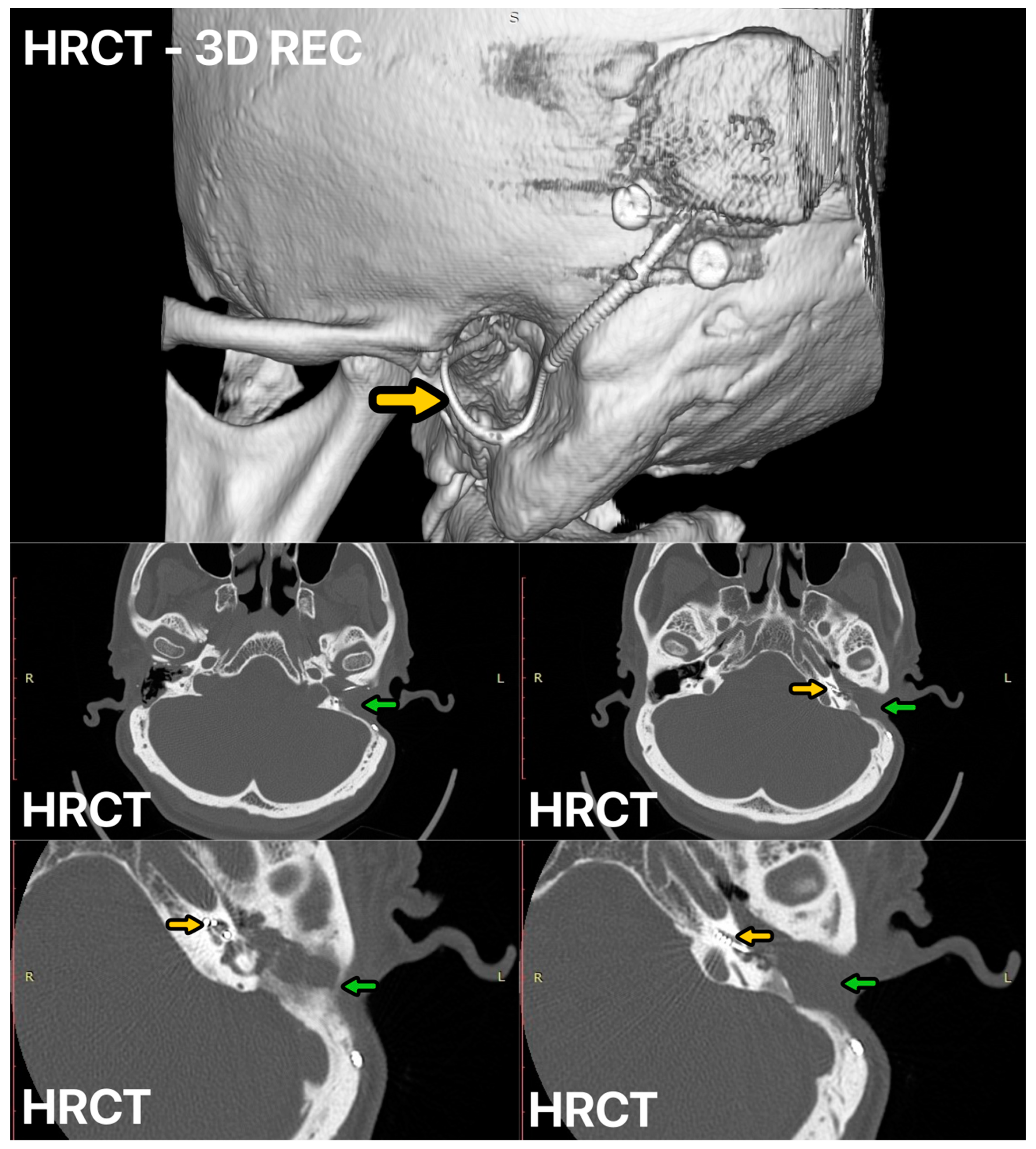 Audiolres 14 00025 g003