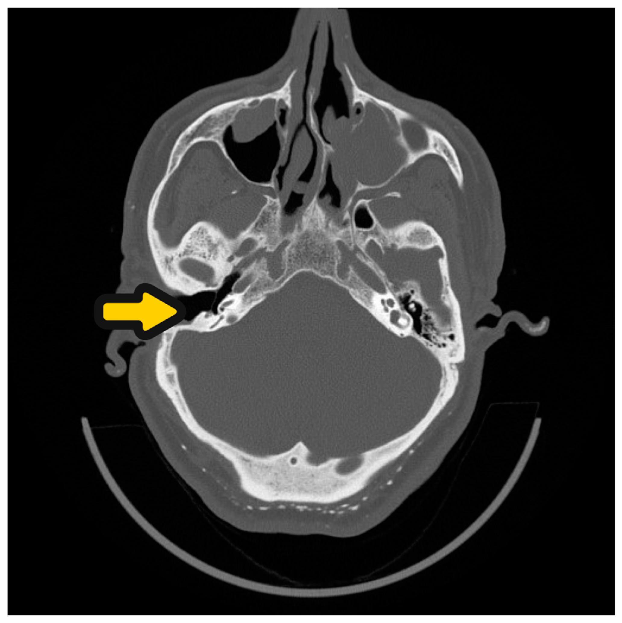 Audiolres 14 00025 g005