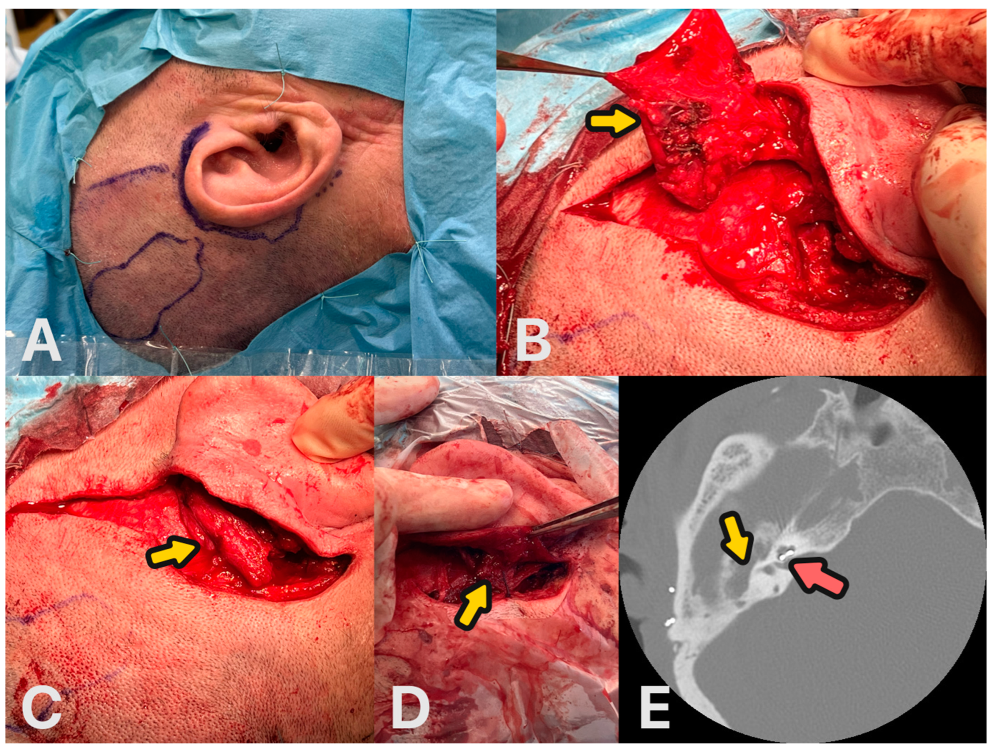 Audiolres 14 00025 g006