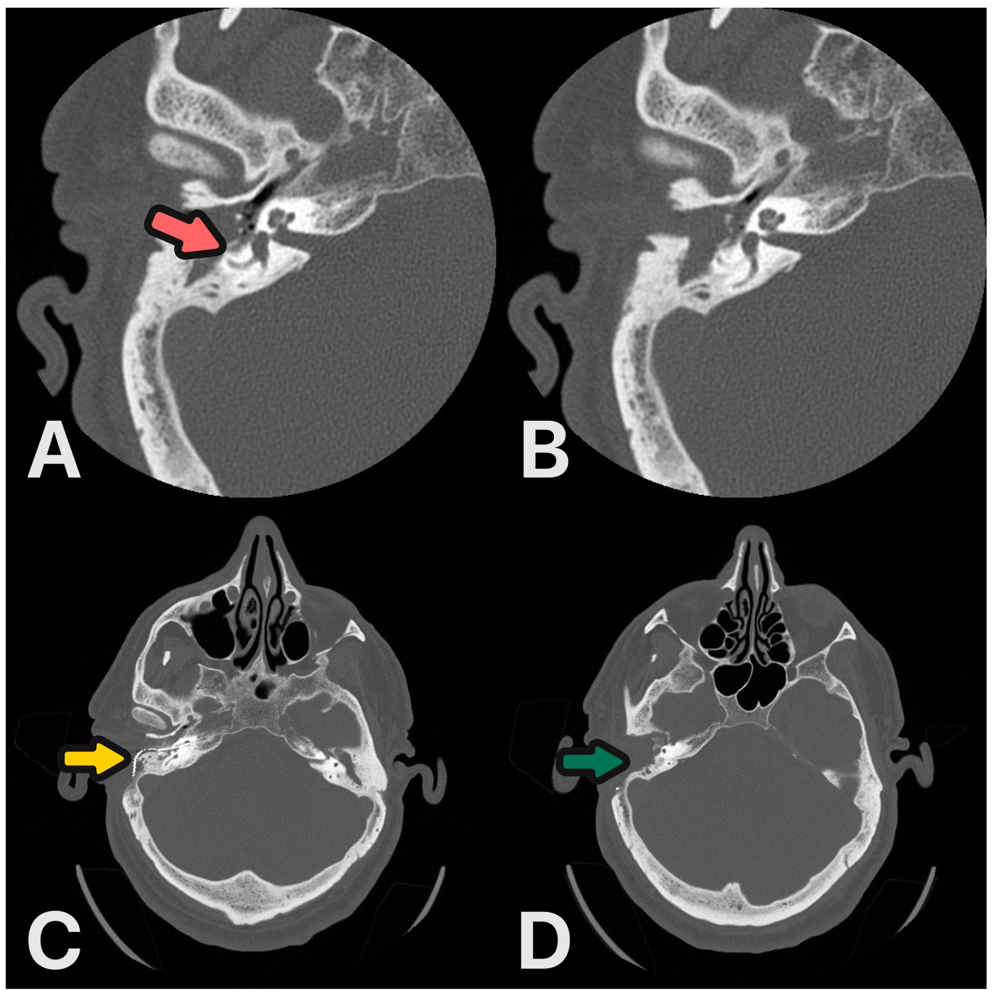 Audiolres 14 00025 g007