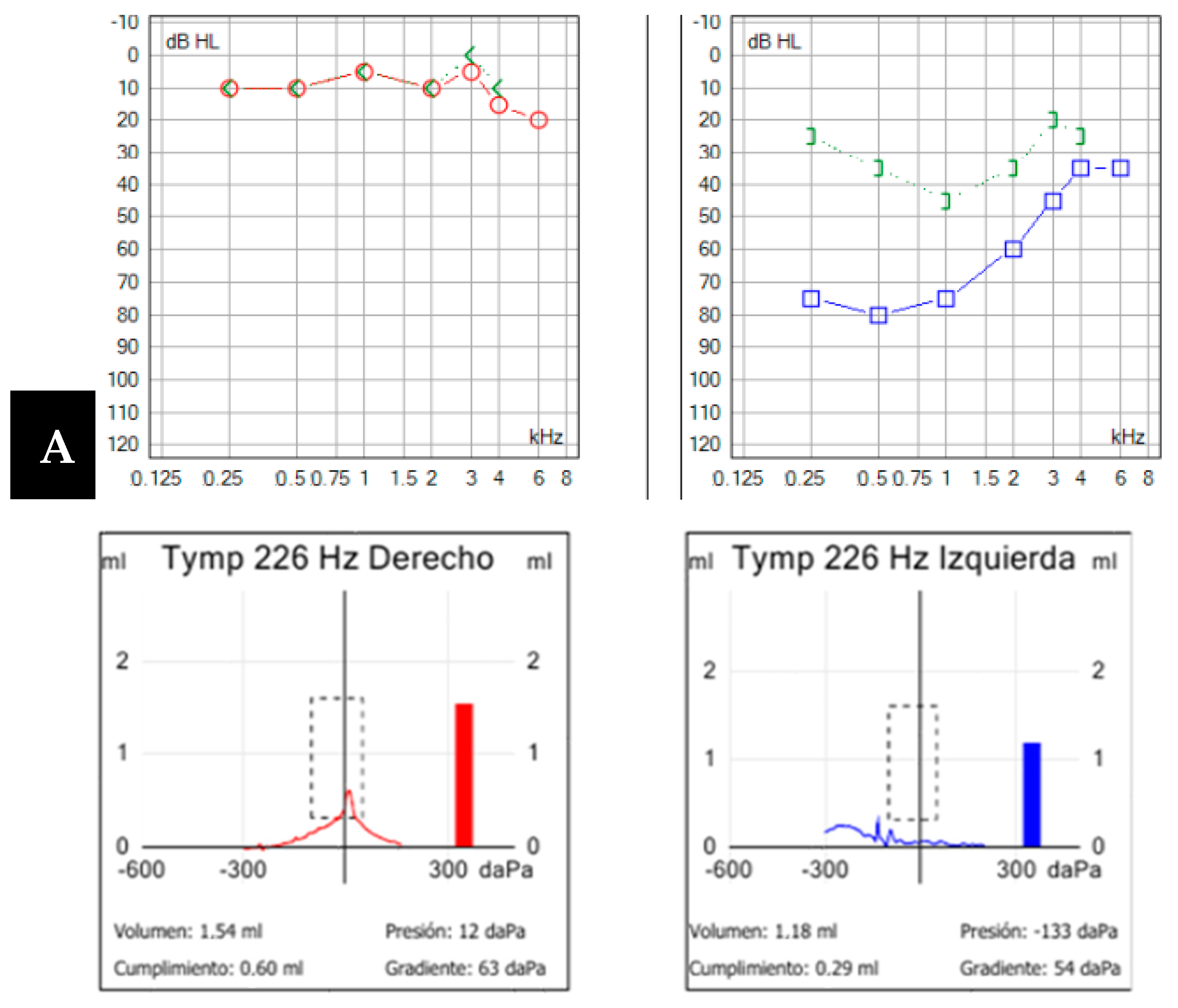 Audiolres 14 00032 g004a