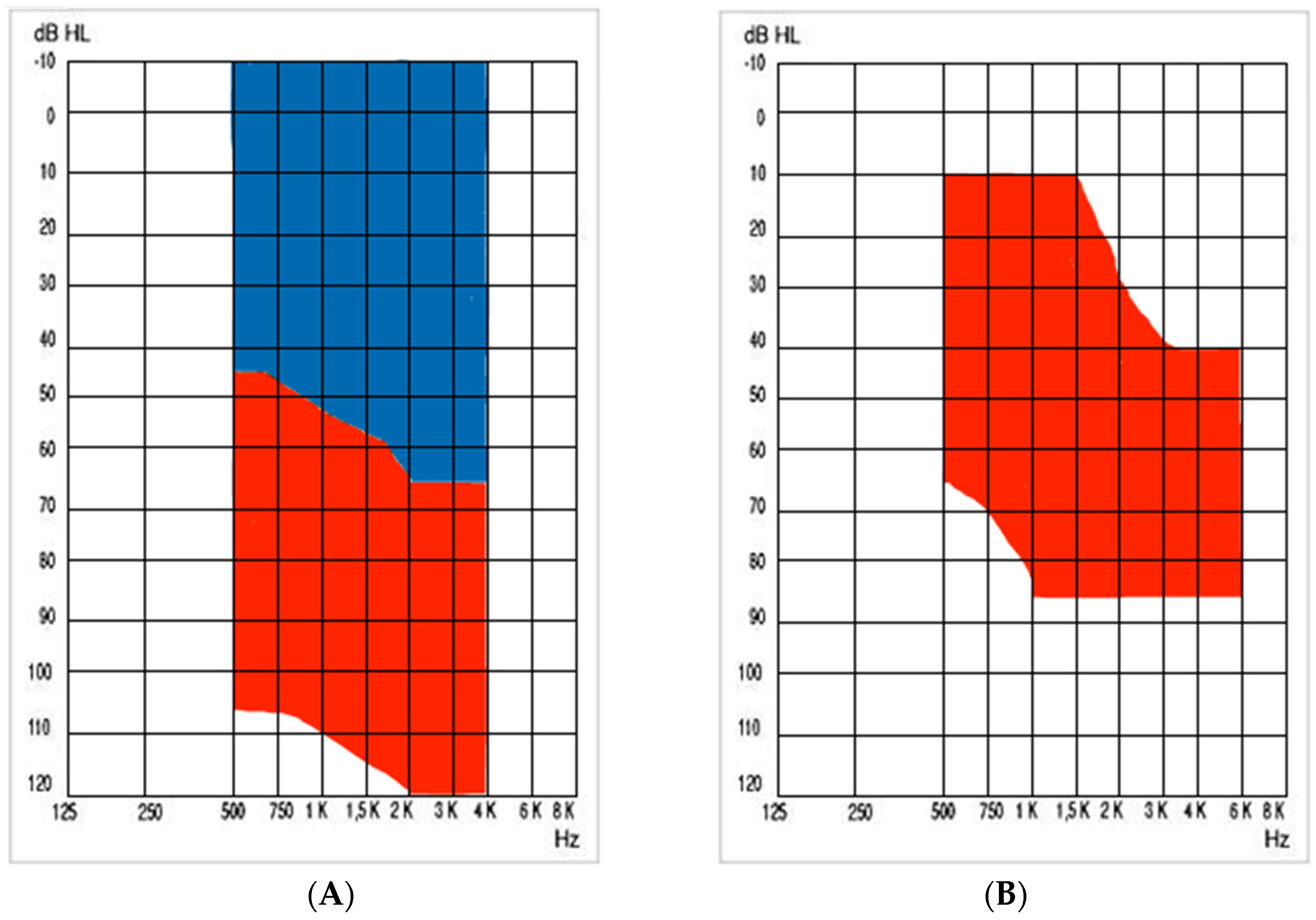 Audiolres 14 00061 g001