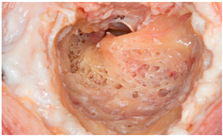 Audiolres 14 00061 i001