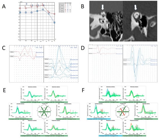 Audiolres 15 00032 g001
