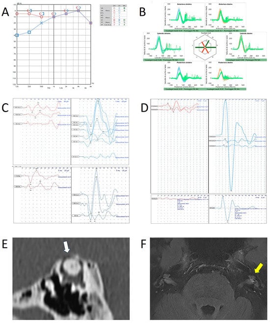 Audiolres 15 00032 g003