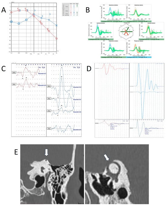 Audiolres 15 00032 g004