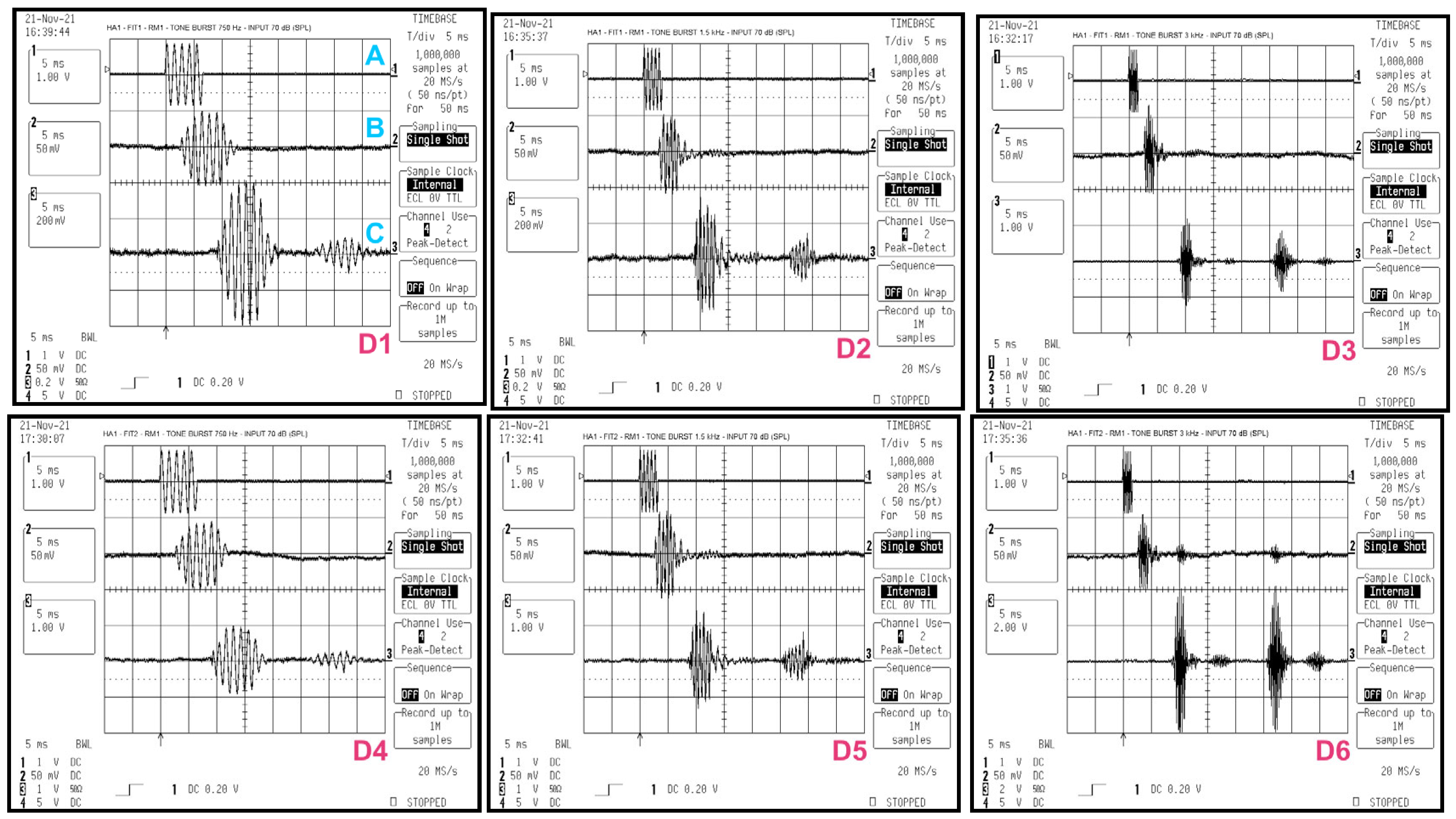 Audiolres 15 00123 g002