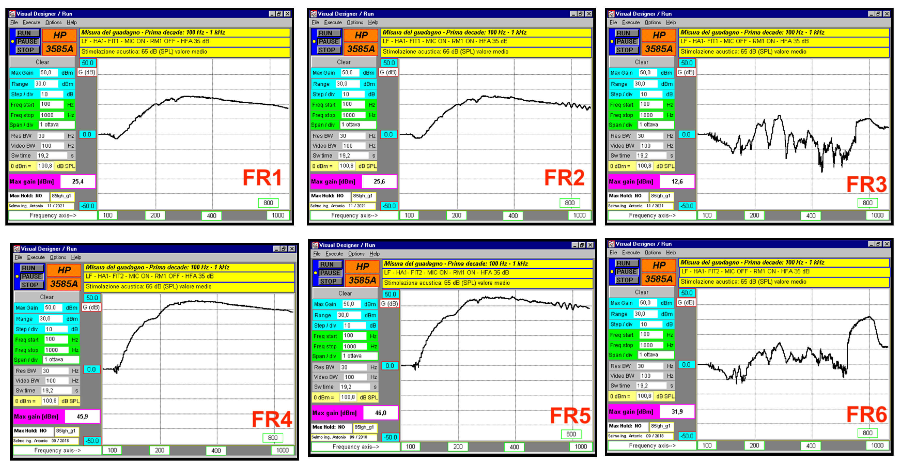 Audiolres 15 00123 g004