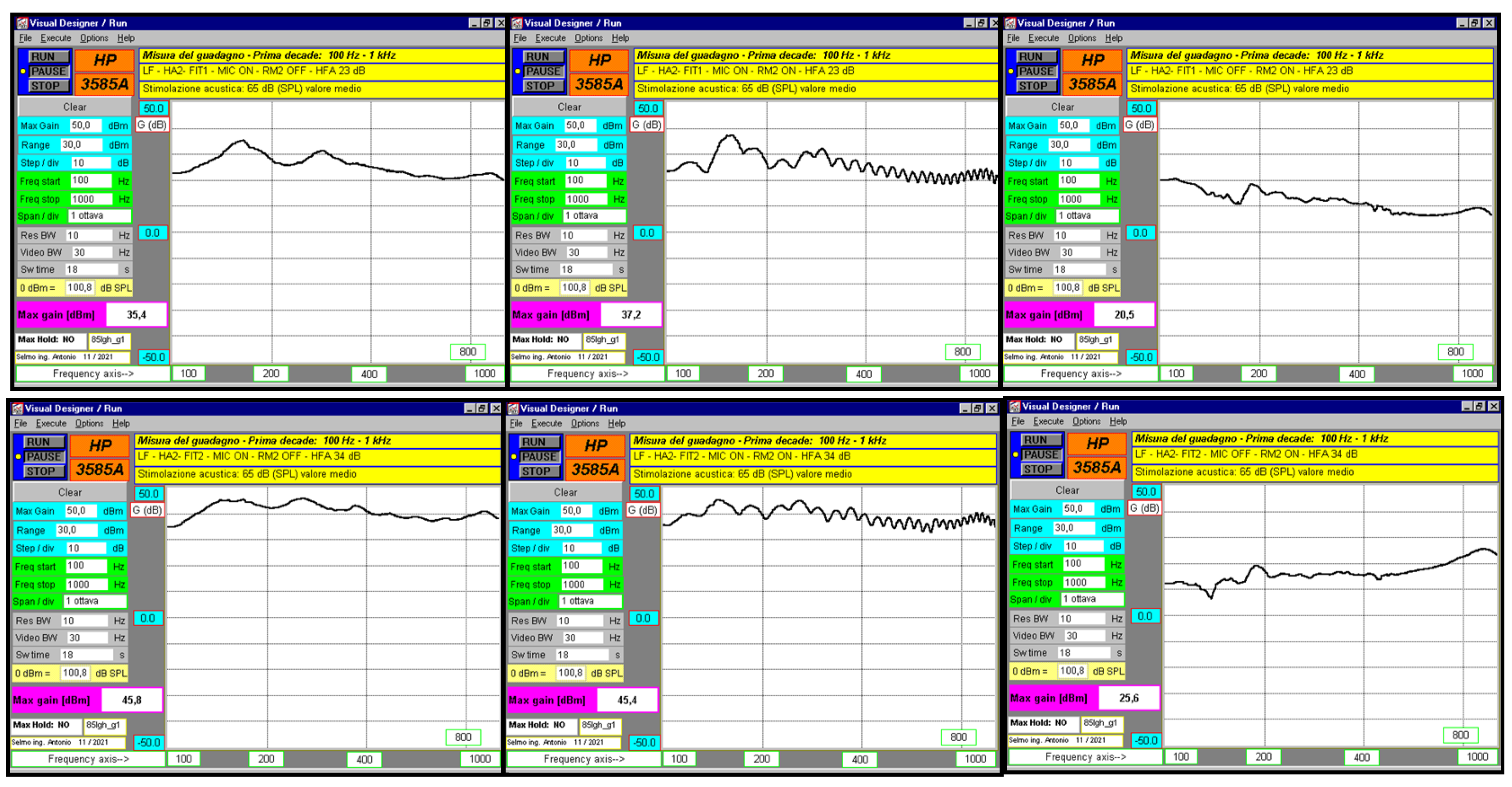 Audiolres 15 00123 g005