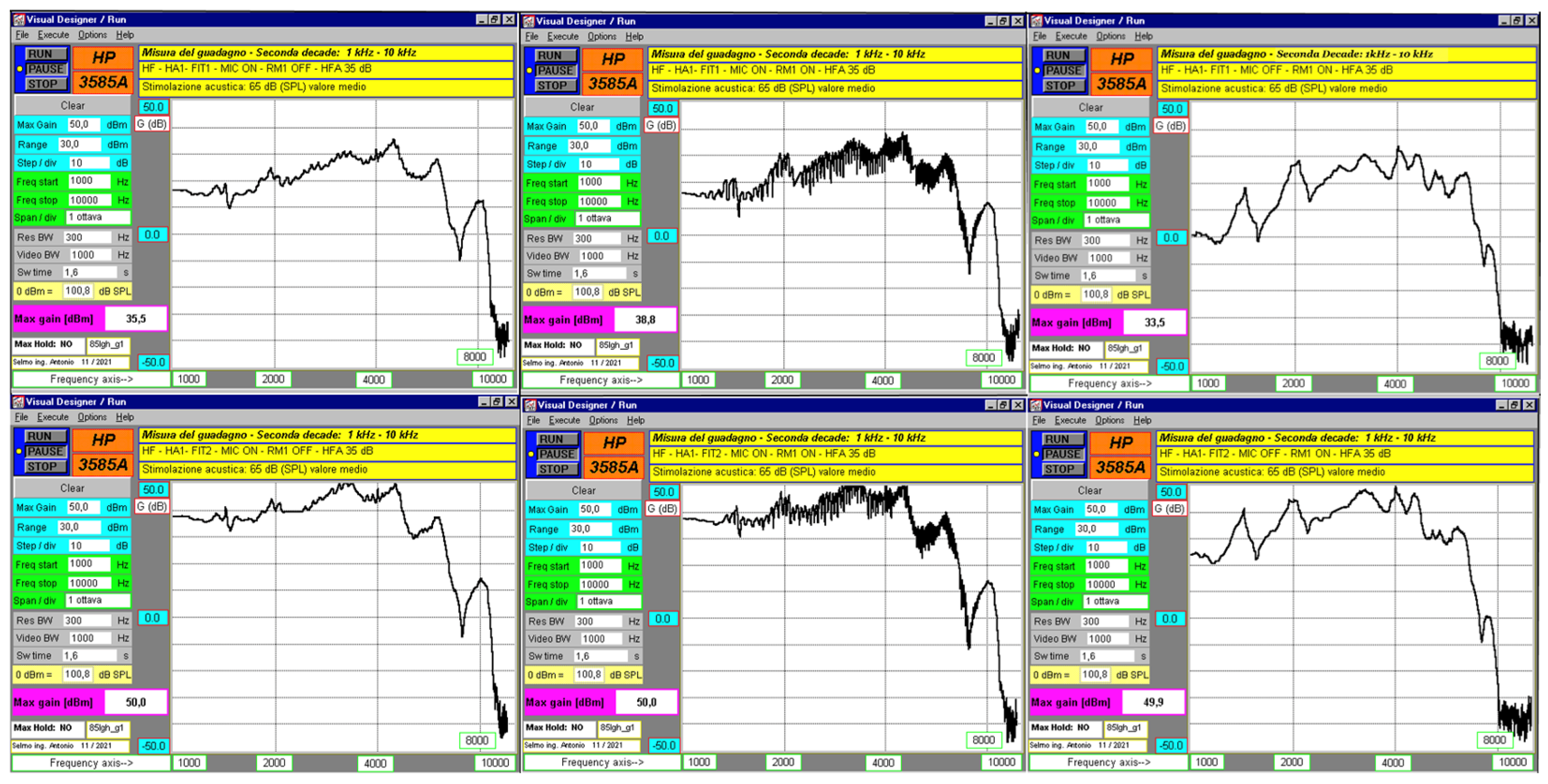 Audiolres 15 00123 g006