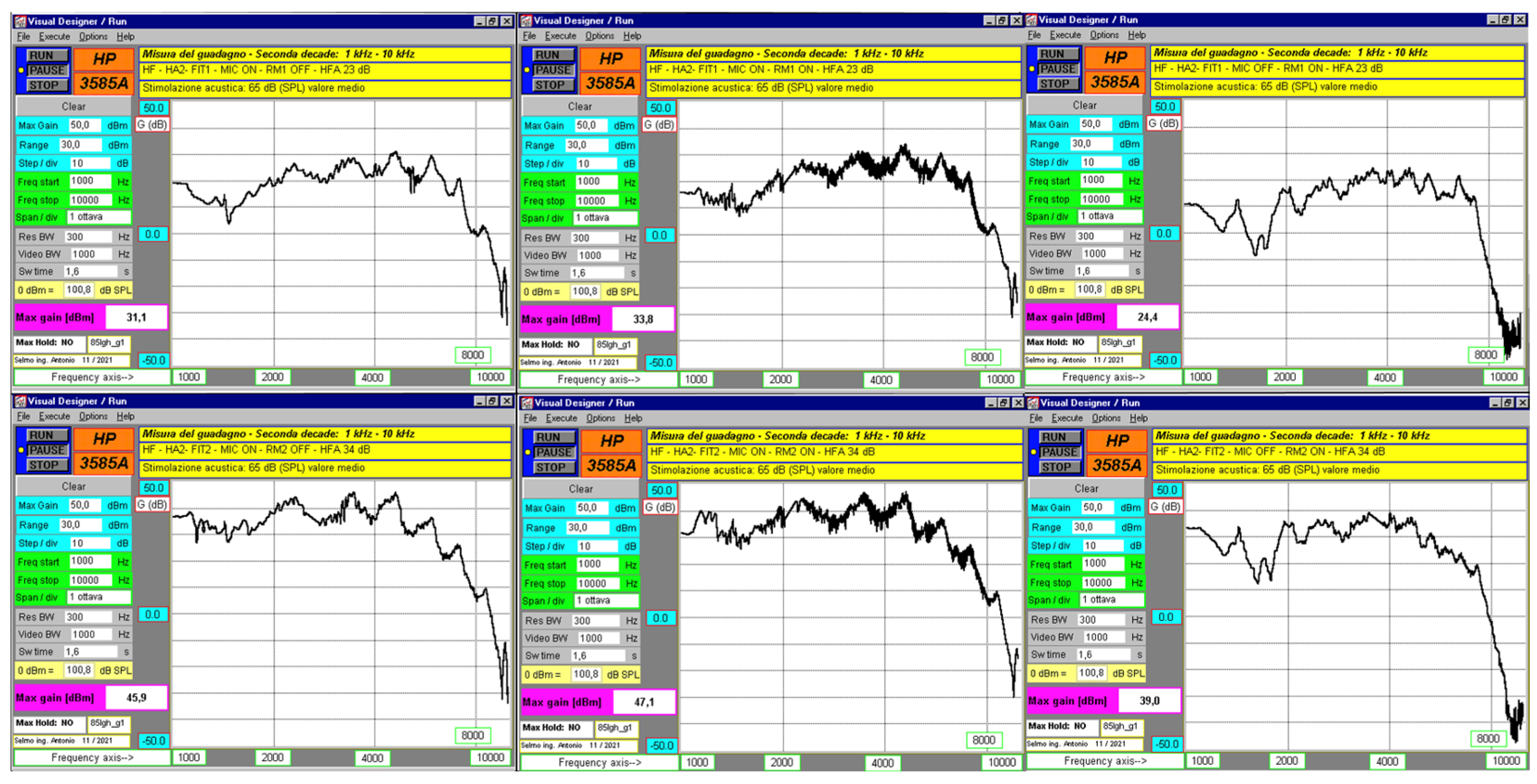 Audiolres 15 00123 g007