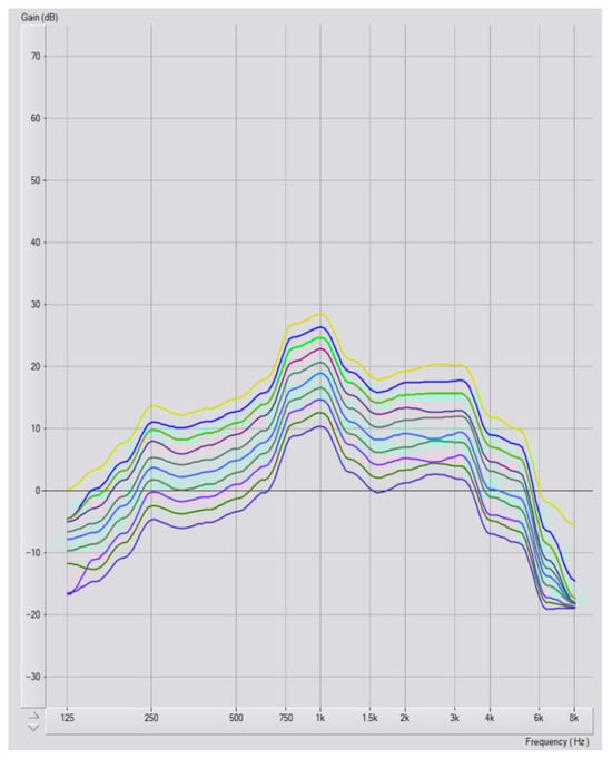 Audiolres 15 00137 g0a1