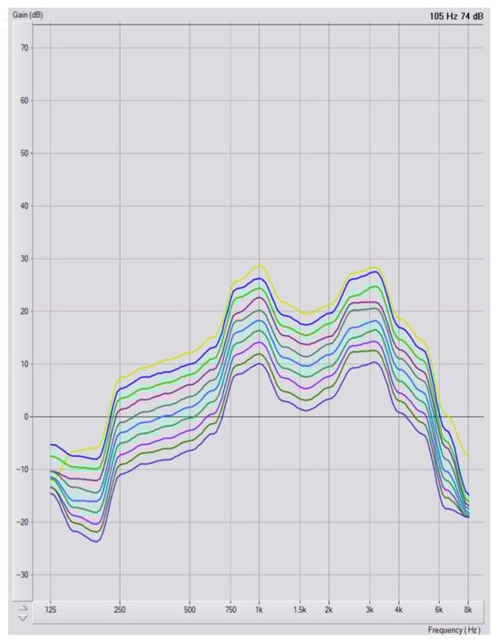 Audiolres 15 00137 g0a2