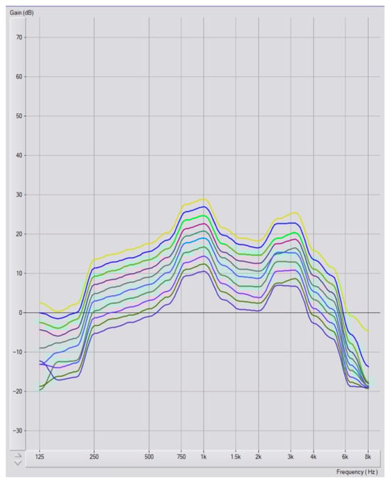 Audiolres 15 00137 g0a3