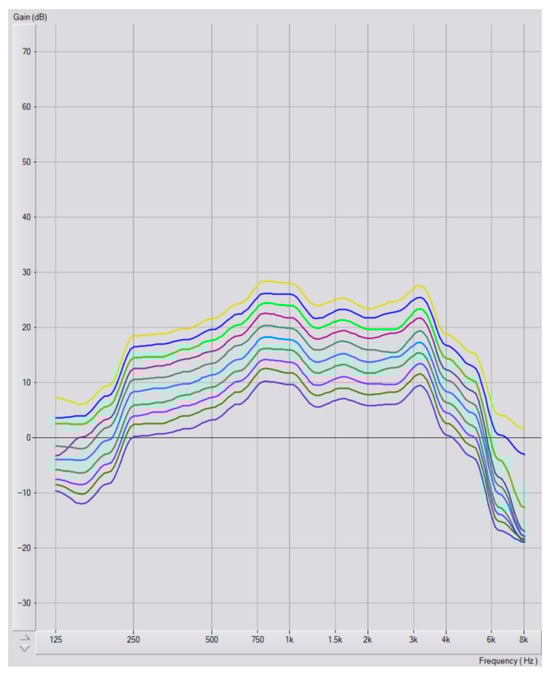 Audiolres 15 00137 g0a4