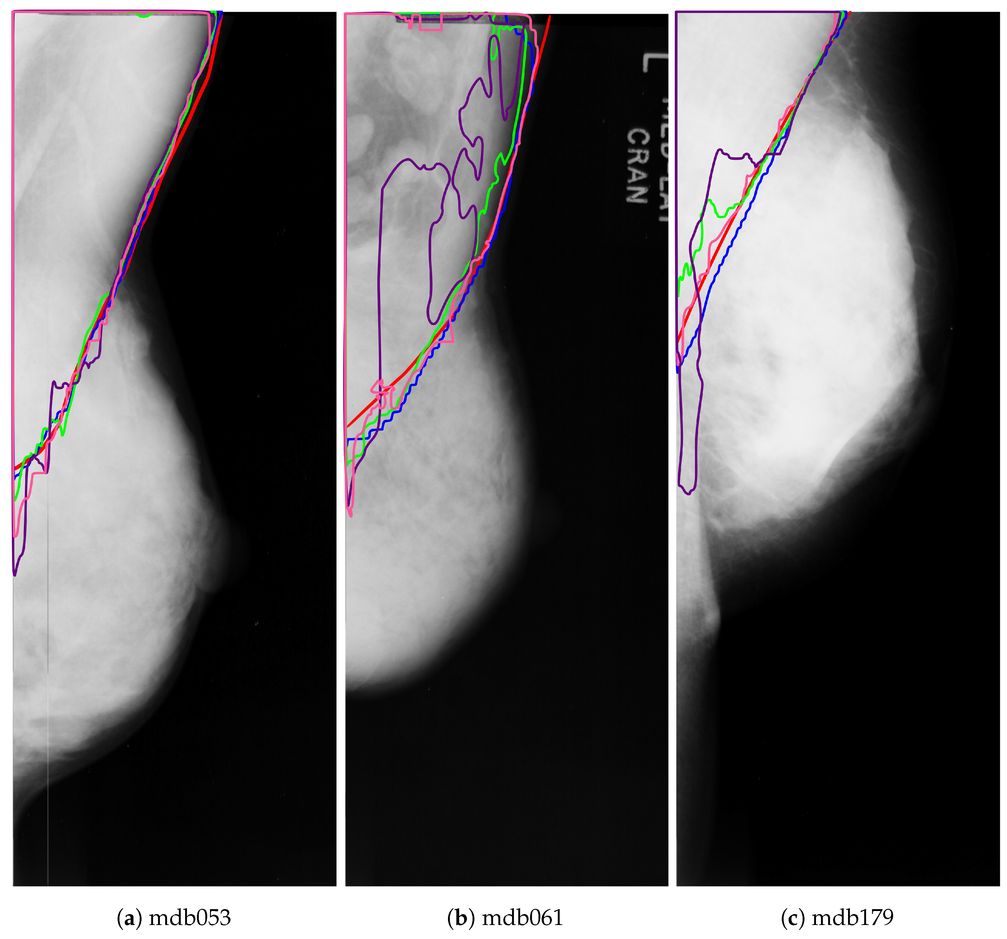 Axioms 10 00180 g015