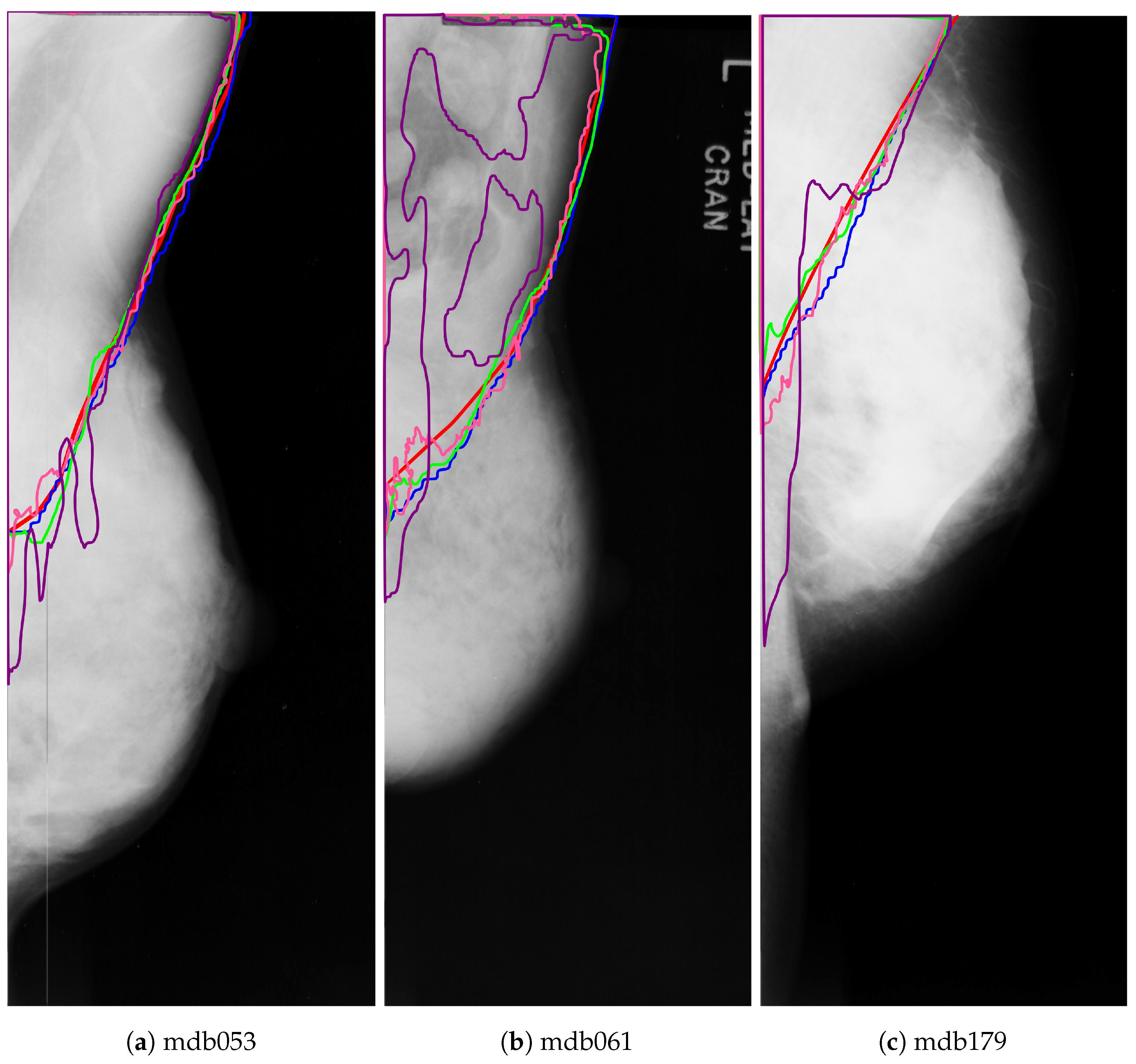 Axioms 10 00180 g016