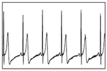 Bioengineering 05 00035 i001