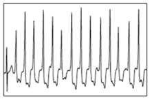 Bioengineering 05 00035 i002