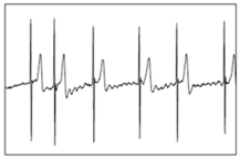 Bioengineering 05 00035 i003