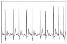 Bioengineering 05 00035 i004
